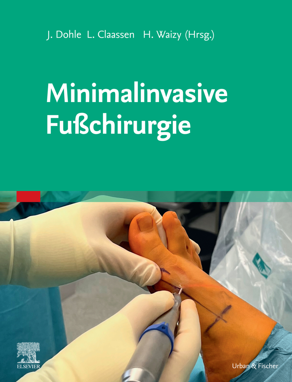 Minimalinvasive FuÃŸchirurgie  â€“ PDF/EPUB Version Downloadable