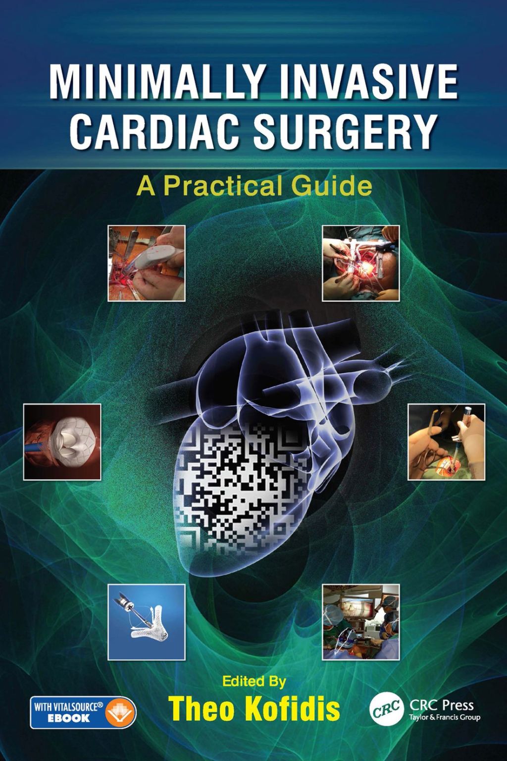 Minimally Invasive Cardiac Surgery A Practical Guide 1st Edition â€“ PDF/EPUB Version Downloadable
