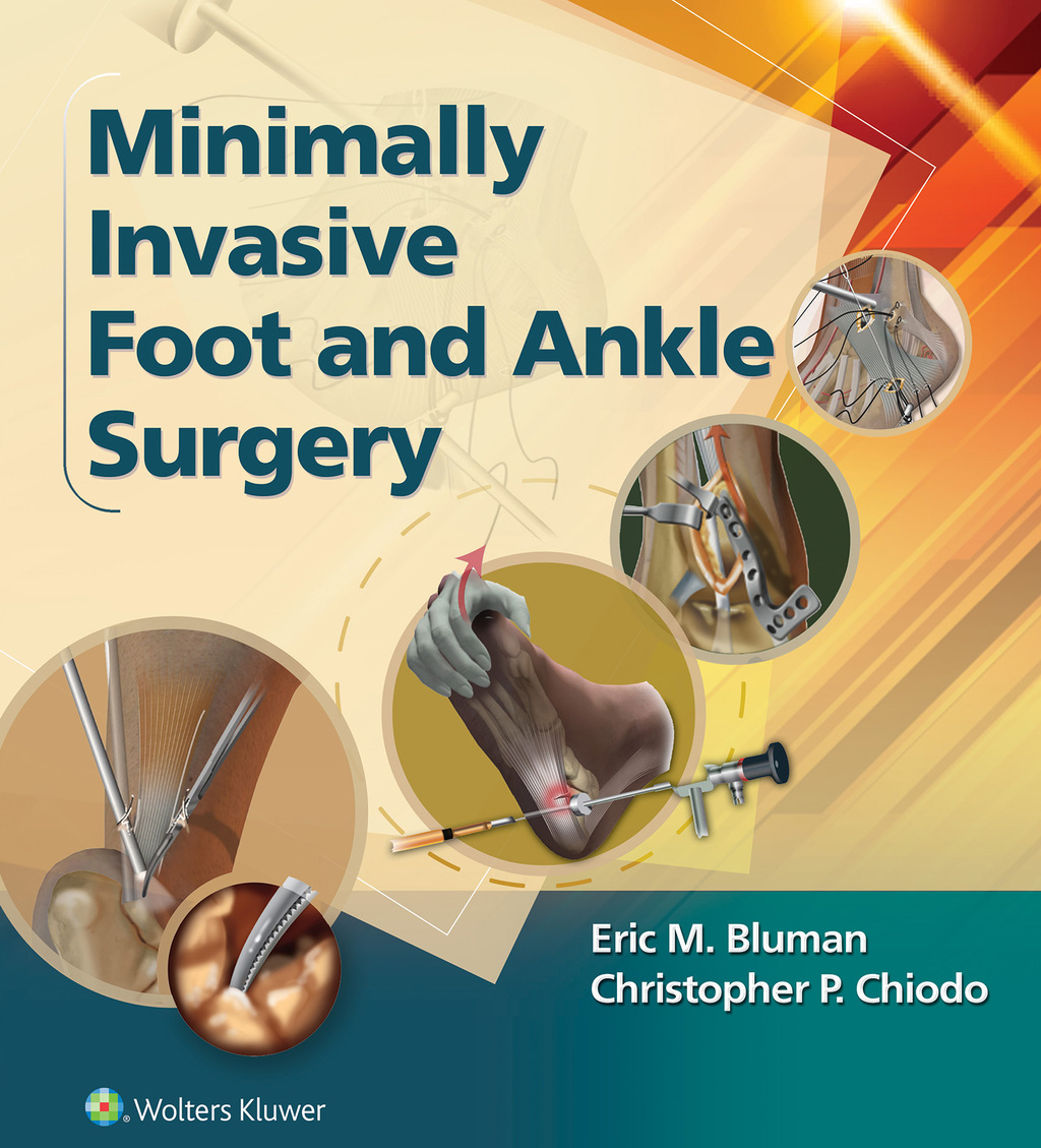 Minimally Invasive Foot & Ankle Surgery  â€“ PDF/EPUB Version Downloadable