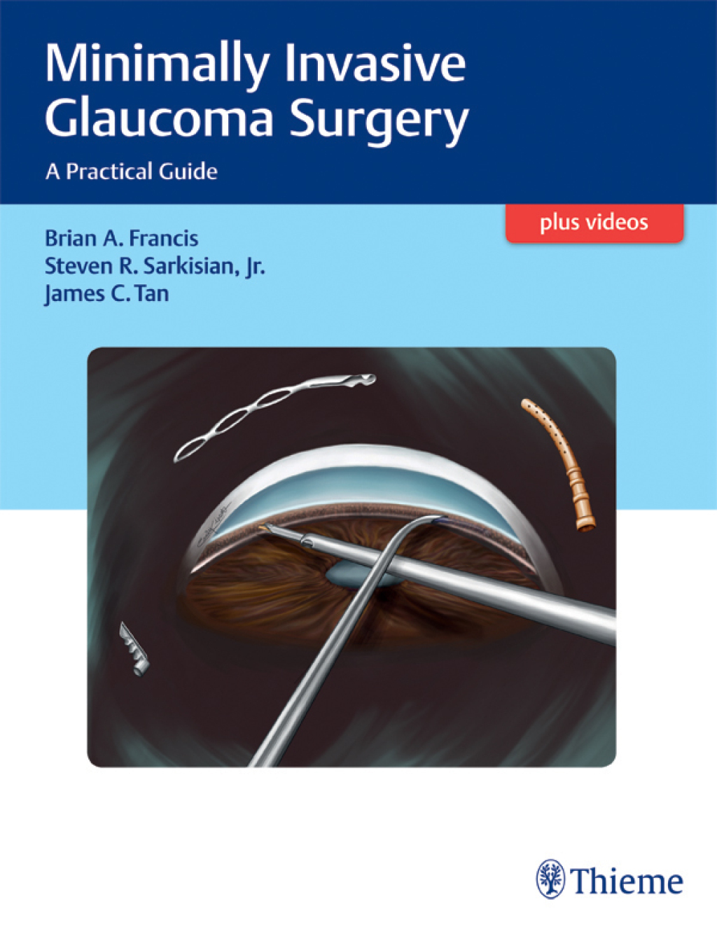 Minimally Invasive Glaucoma Surgery A Practical Guide 1st Edition â€“ PDF/EPUB Version Downloadable
