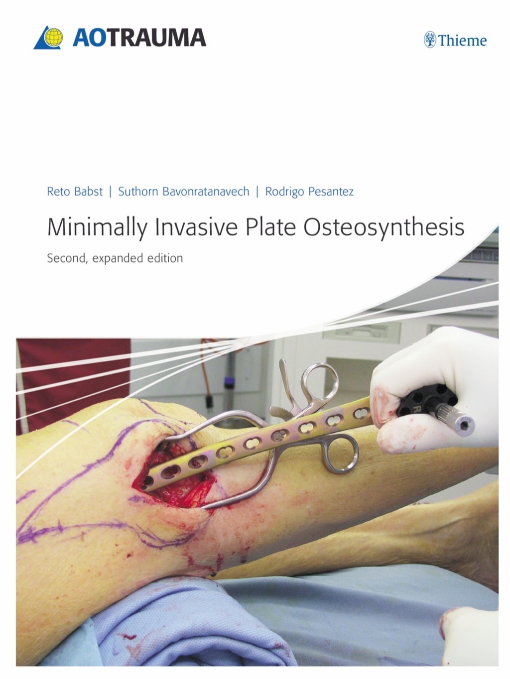 Minimally Invasive Plate Osteosynthesis (MIPO) 2nd Edition â€“ PDF/EPUB Version Downloadable