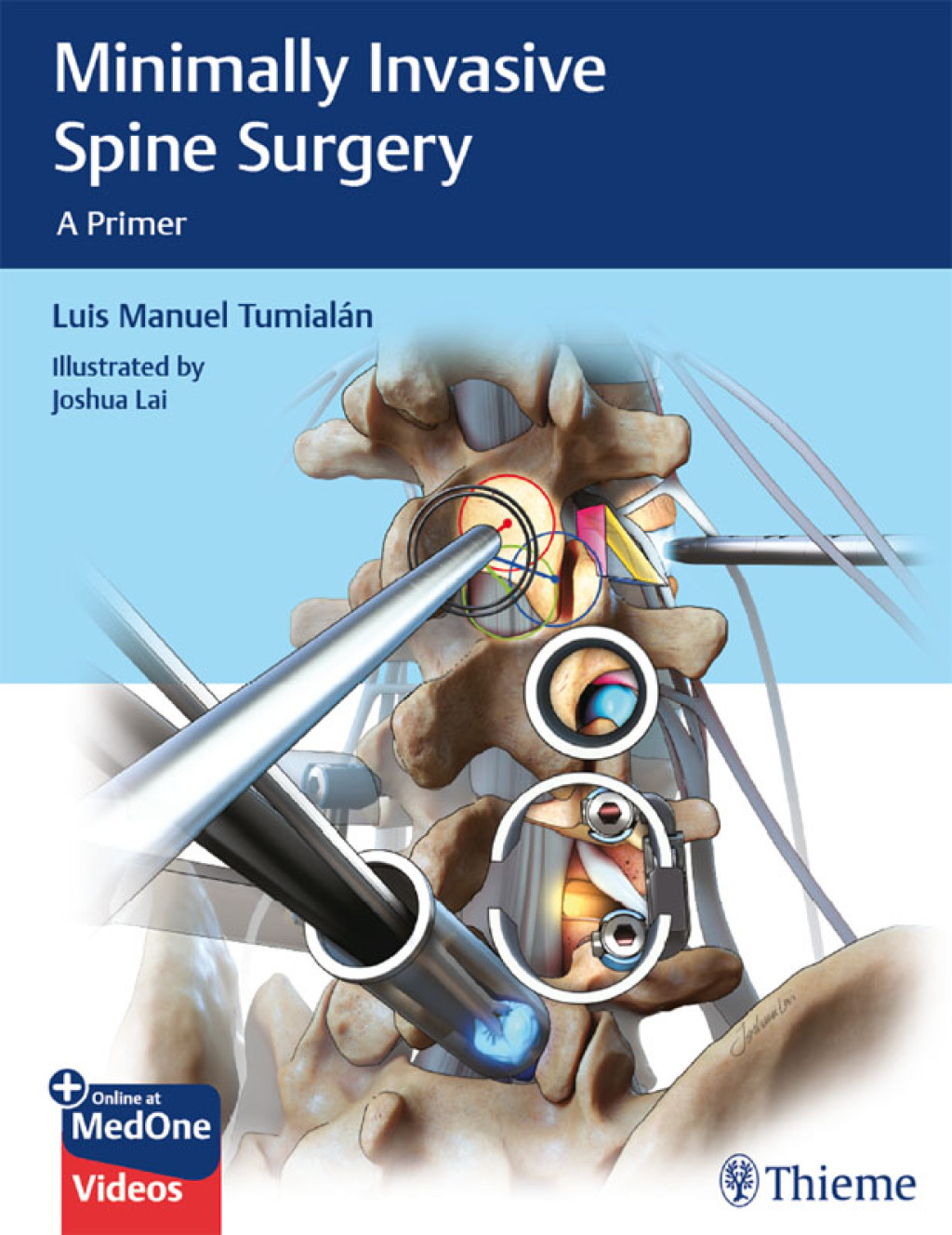 Minimally Invasive Spine Surgery A Primer 1st Edition â€“ PDF/EPUB Version Downloadable