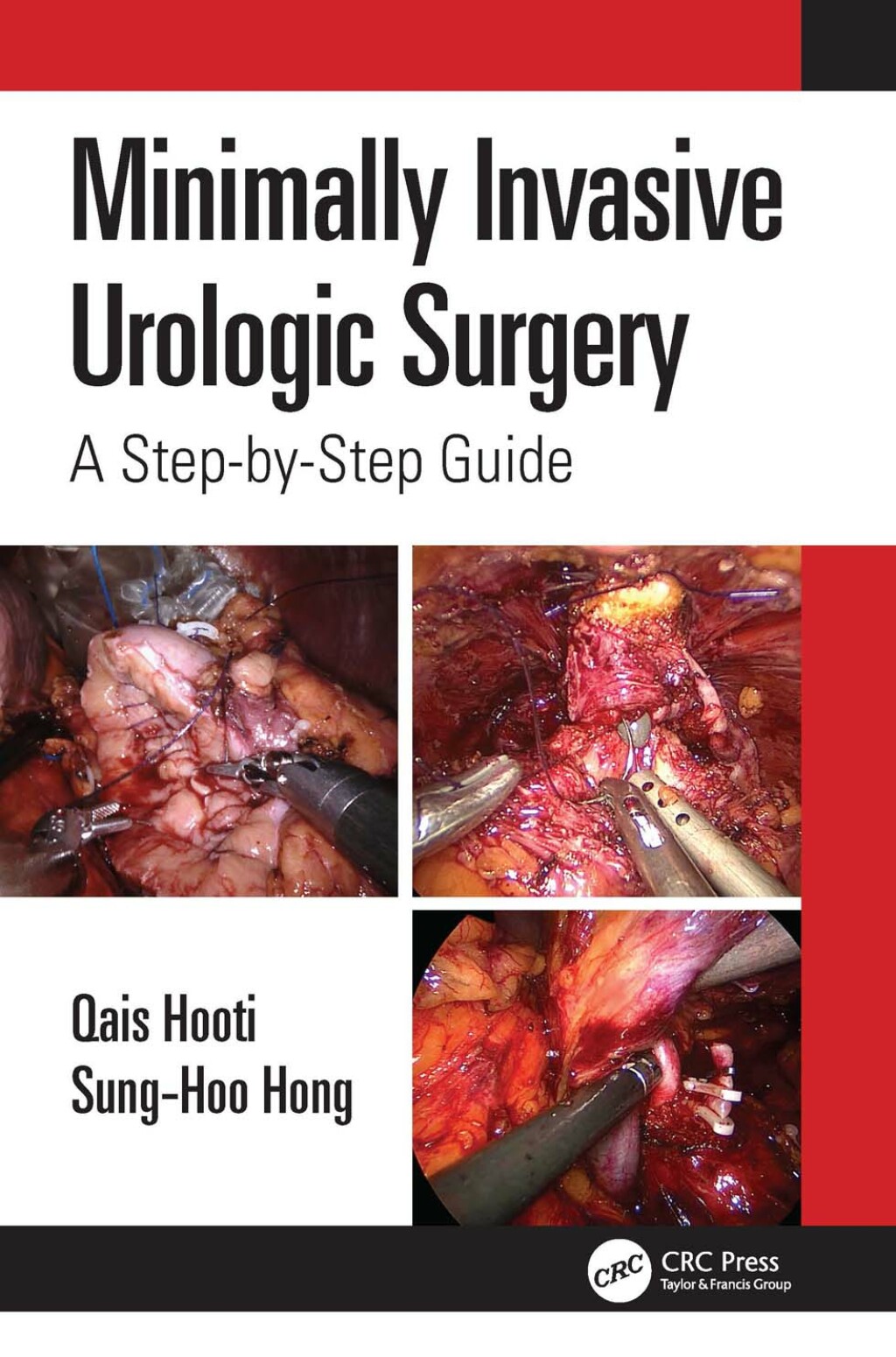 Minimally Invasive Urologic Surgery A Step-by-Step Guide 1st Edition â€“ PDF/EPUB Version Downloadable