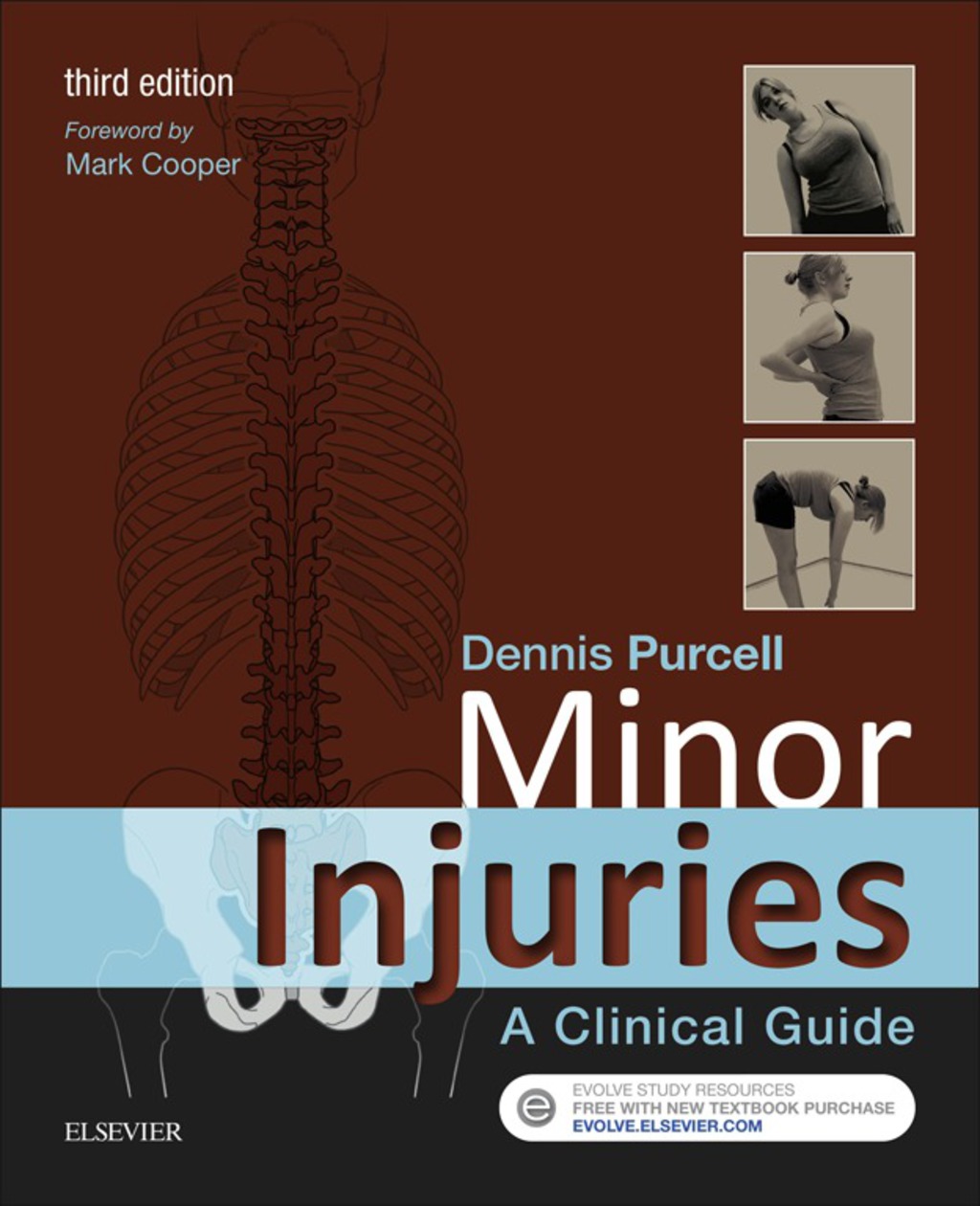 Minor Injuries: A Clinical Guide 3rd Edition - (PDF/EPUB Version)