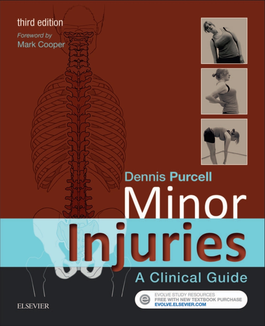 Minor Injuries E-Book Minor Injuries E-Book 3rd Edition - (PDF/EPUB Version)