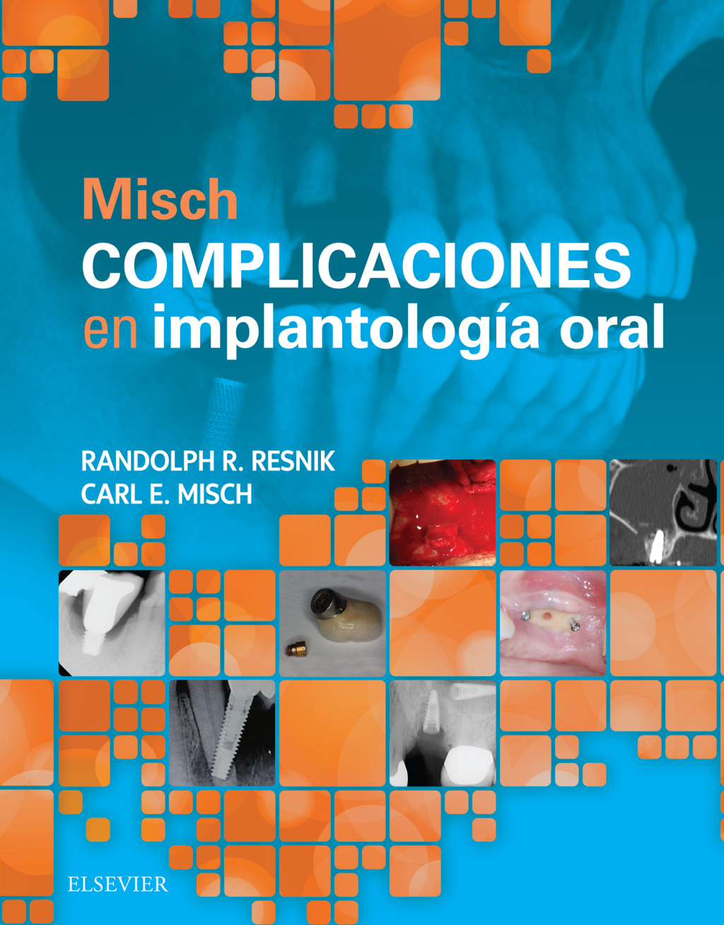 Misch. Complicaciones en implantologÃ­a oral  â€“ PDF/EPUB Version Downloadable