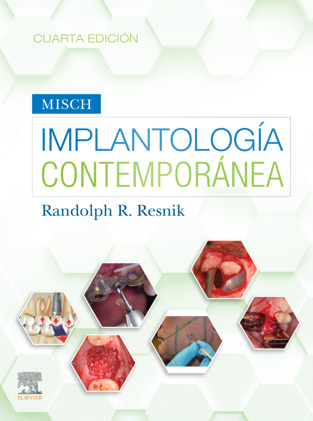 Misch. ImplantologÃ­a contemporÃ¡nea 4th Edition â€“ PDF/EPUB Version Downloadable