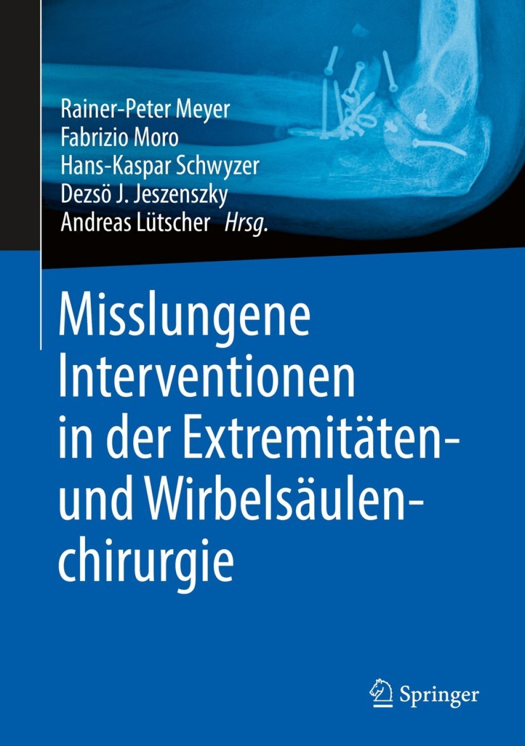 Misslungene Interventionen in der ExtremitÃ¤ten- und WirbelsÃ¤ulenchirurgie 1st Edition â€“ PDF/EPUB Version Downloadable