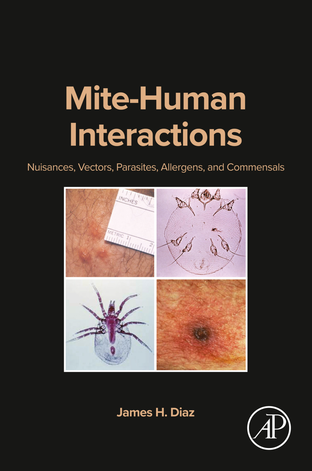 Mite-Human Interactions Nuisances, Vectors, Parasites, Allergens, and Commensals 1st Edition â€“ PDF/EPUB Version Downloadable