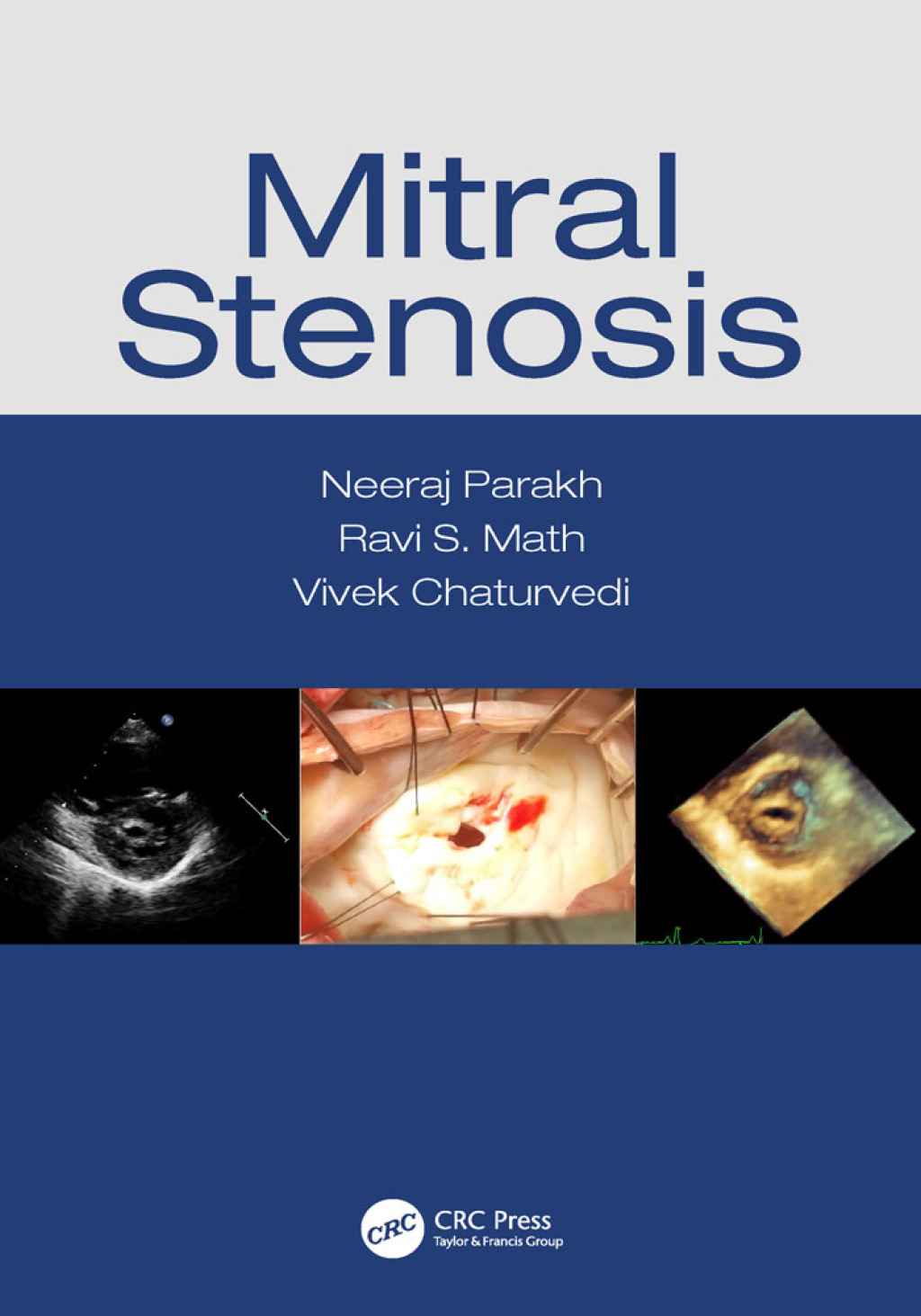 Mitral Stenosis 1st Edition â€“ PDF/EPUB Version Downloadable