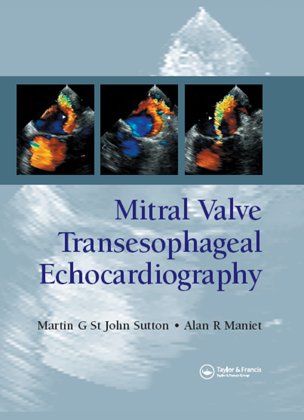 Mitral Valve Transesophageal Echocardiography 1st Edition â€“ PDF/EPUB Version Downloadable