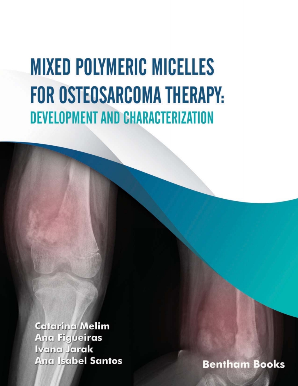 Mixed Polymeric Micelles for Osteosarcoma Therapy: Development and Characterization 1st Edition â€“ PDF/EPUB Version Downloadable