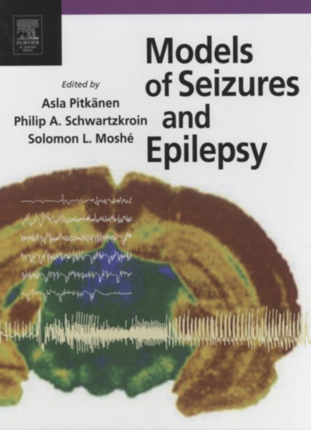 Models of Seizures and Epilepsy  â€“ PDF/EPUB Version Downloadable