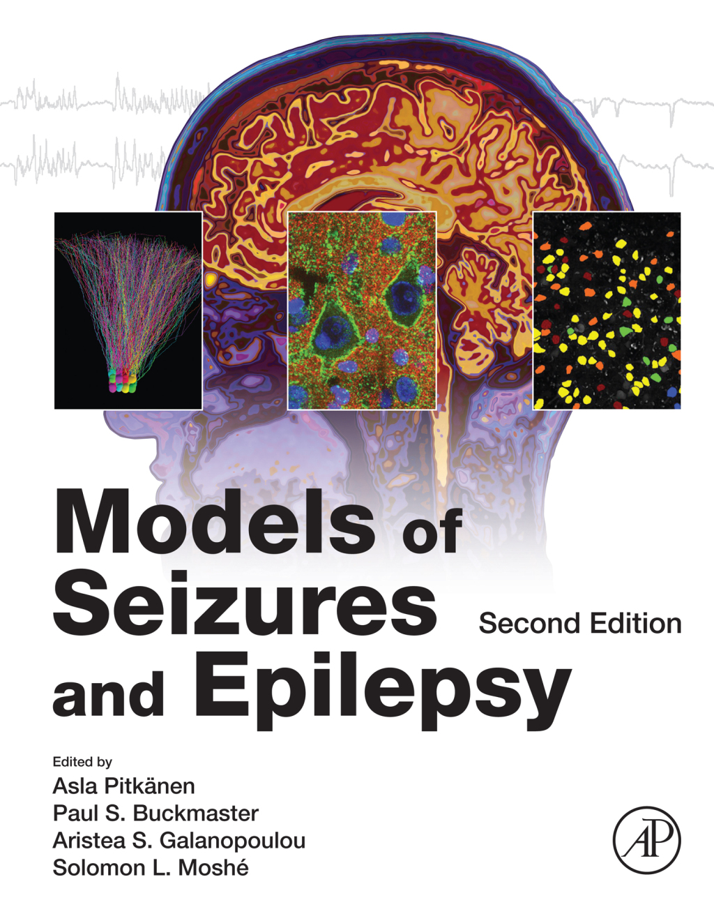 Models of Seizures and Epilepsy 2nd Edition â€“ PDF/EPUB Version Downloadable