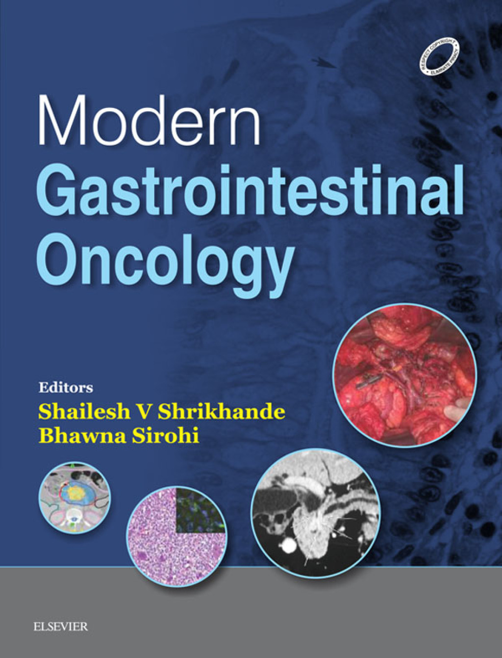 Modern GI Oncology 1st Edition â€“ PDF/EPUB Version Downloadable
