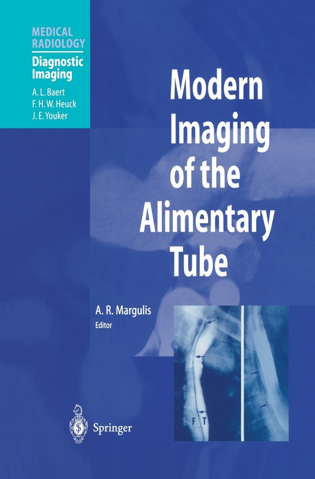 Modern Imaging of the Alimentary Tube 1st Edition â€“ PDF/EPUB Version Downloadable