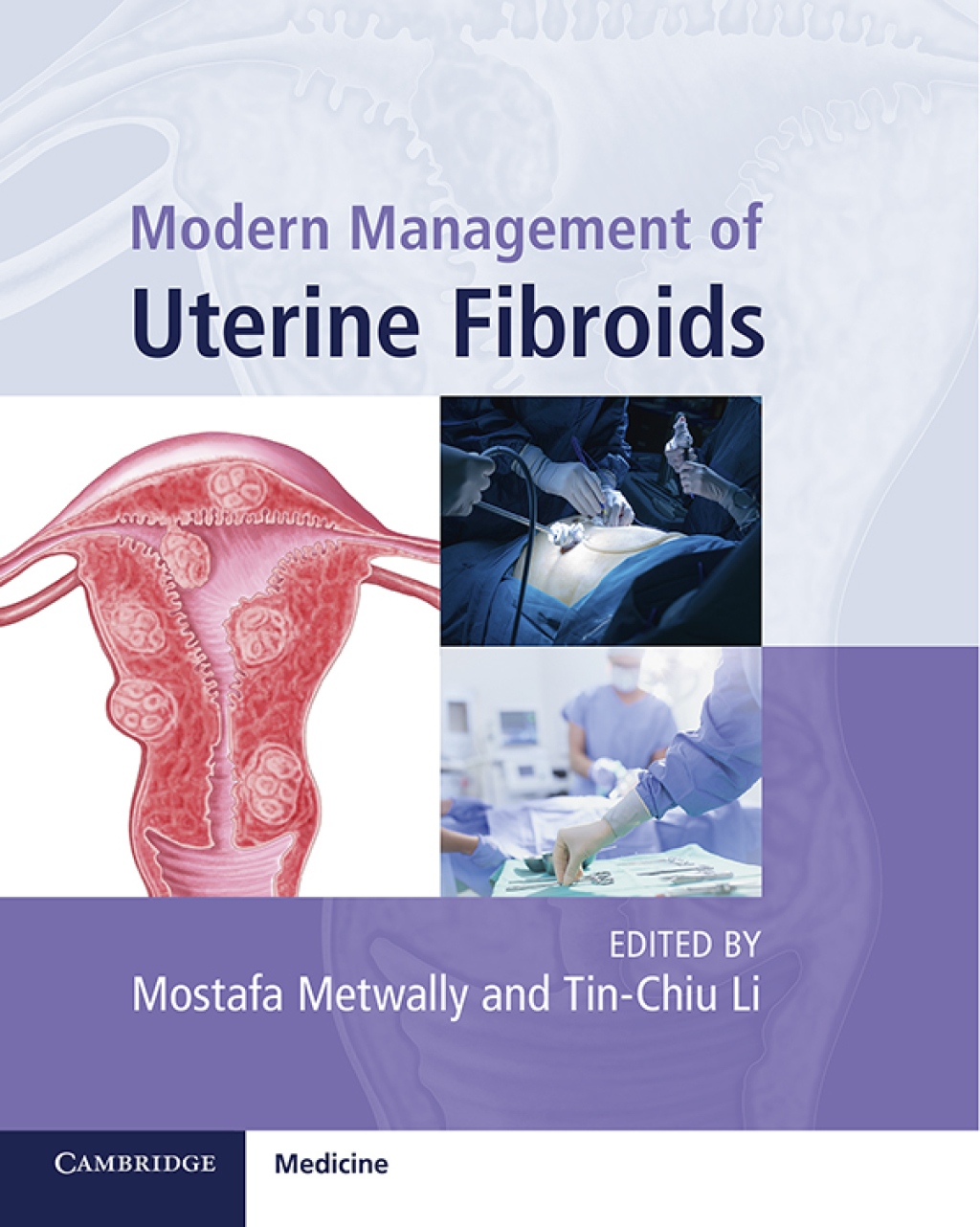 Modern Management of Uterine Fibroids  â€“ PDF/EPUB Version Downloadable