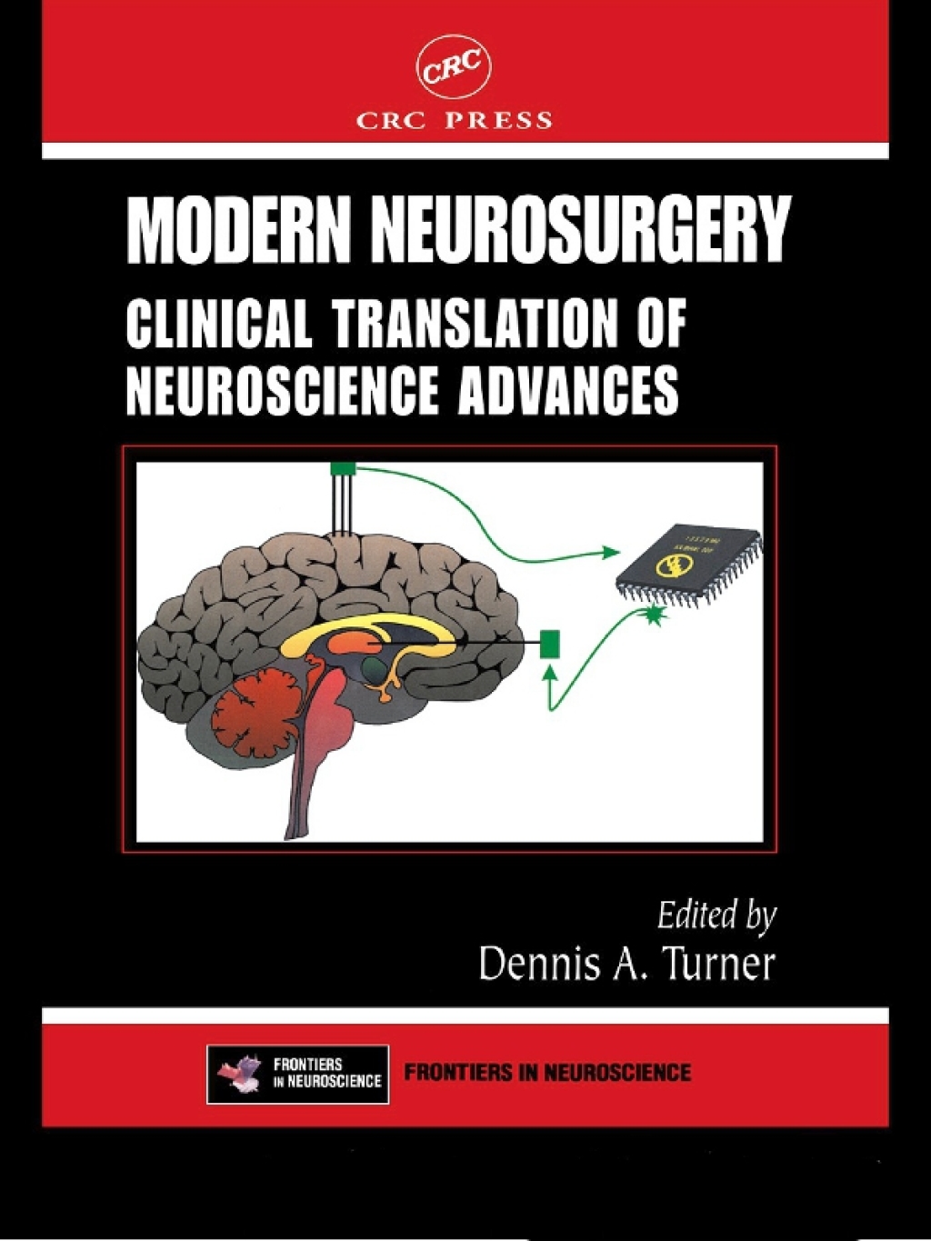 Modern Neurosurgery Clinical Translation of Neuroscience Advances 1st Edition â€“ PDF/EPUB Version Downloadable