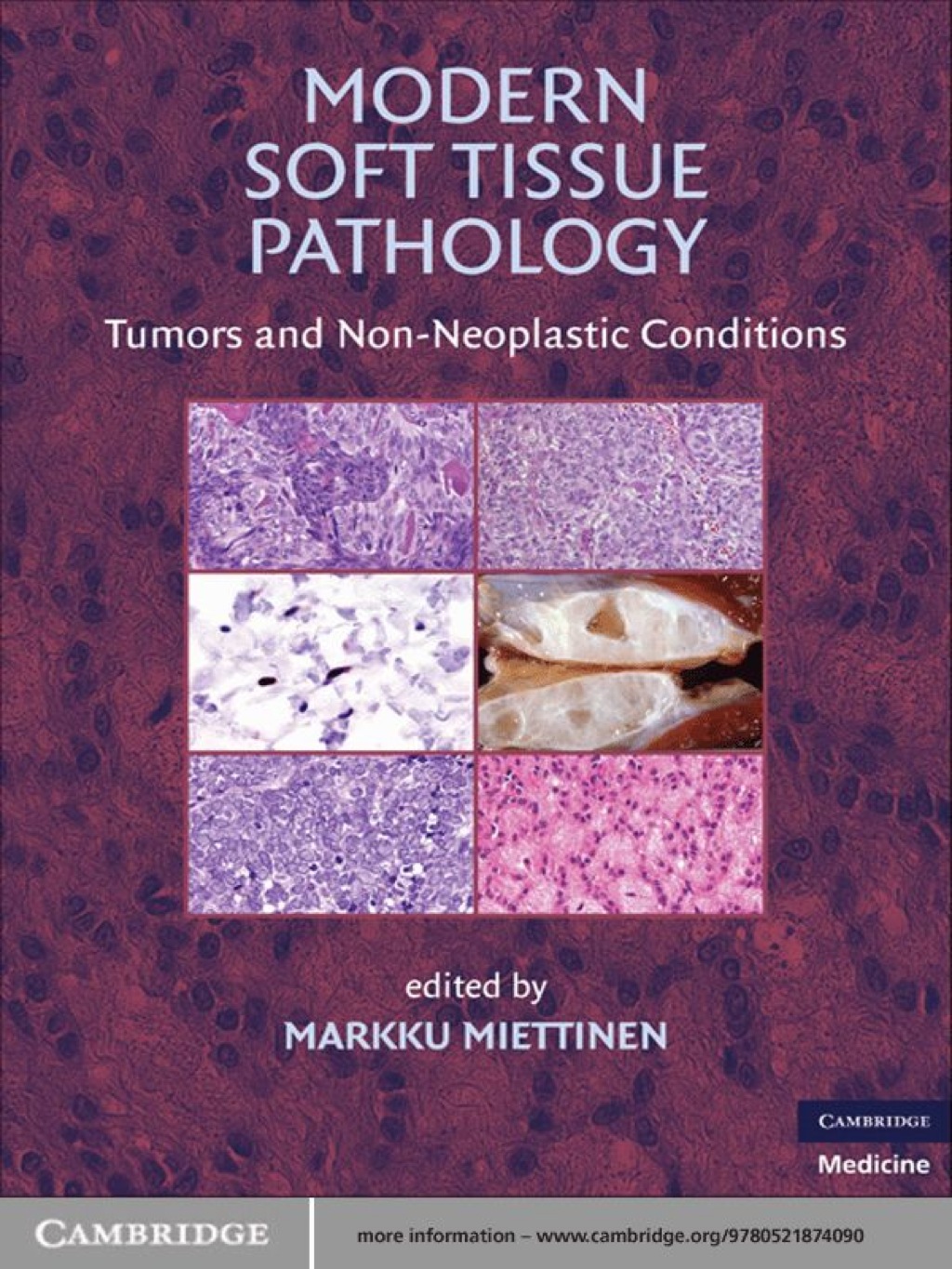 Modern Soft Tissue Pathology Tumors and Non-Neoplastic Conditions 1st Edition â€“ PDF/EPUB Version Downloadable