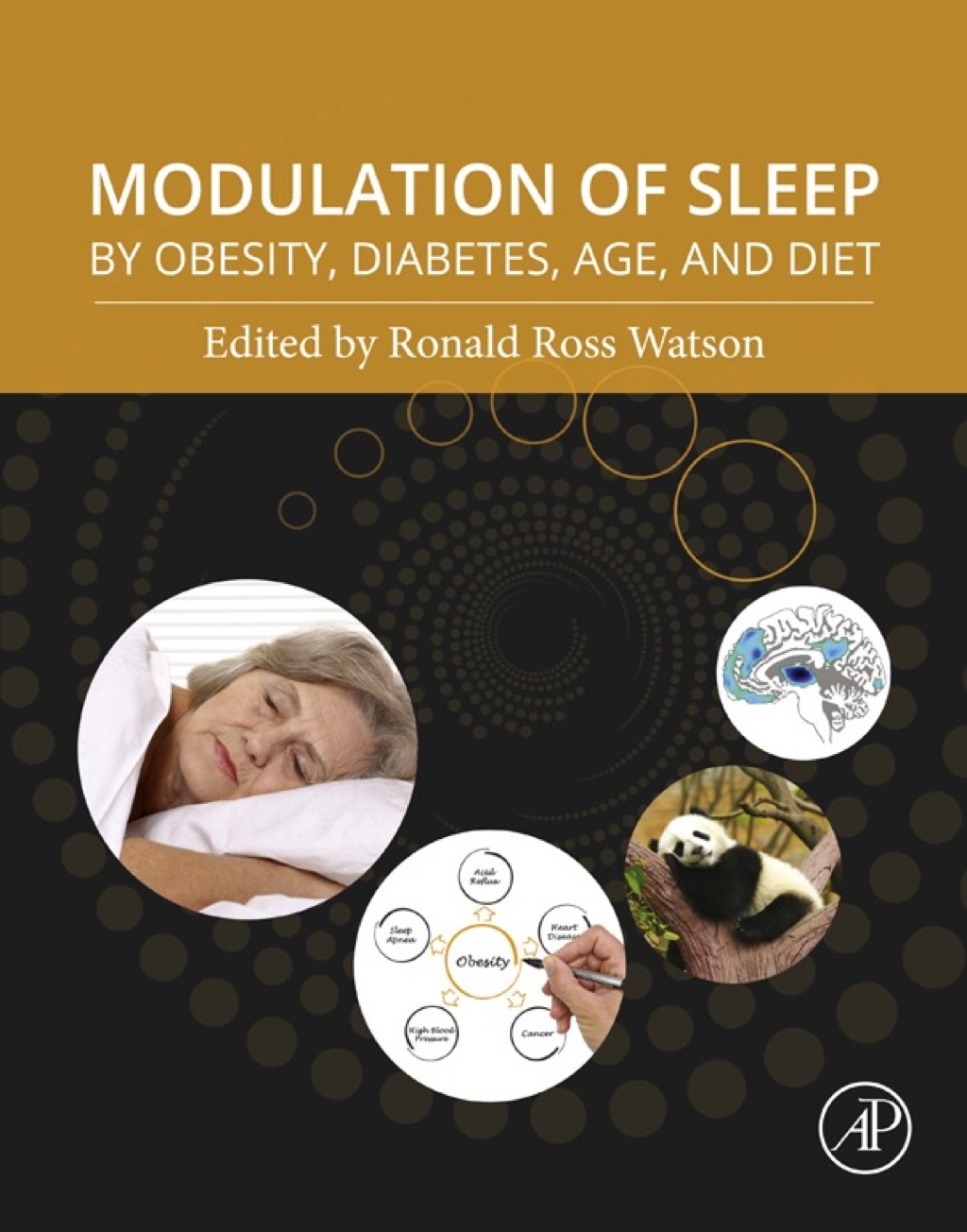 Modulation of Sleep by Obesity, Diabetes, Age, and Diet 1st Edition â€“ PDF/EPUB Version Downloadable