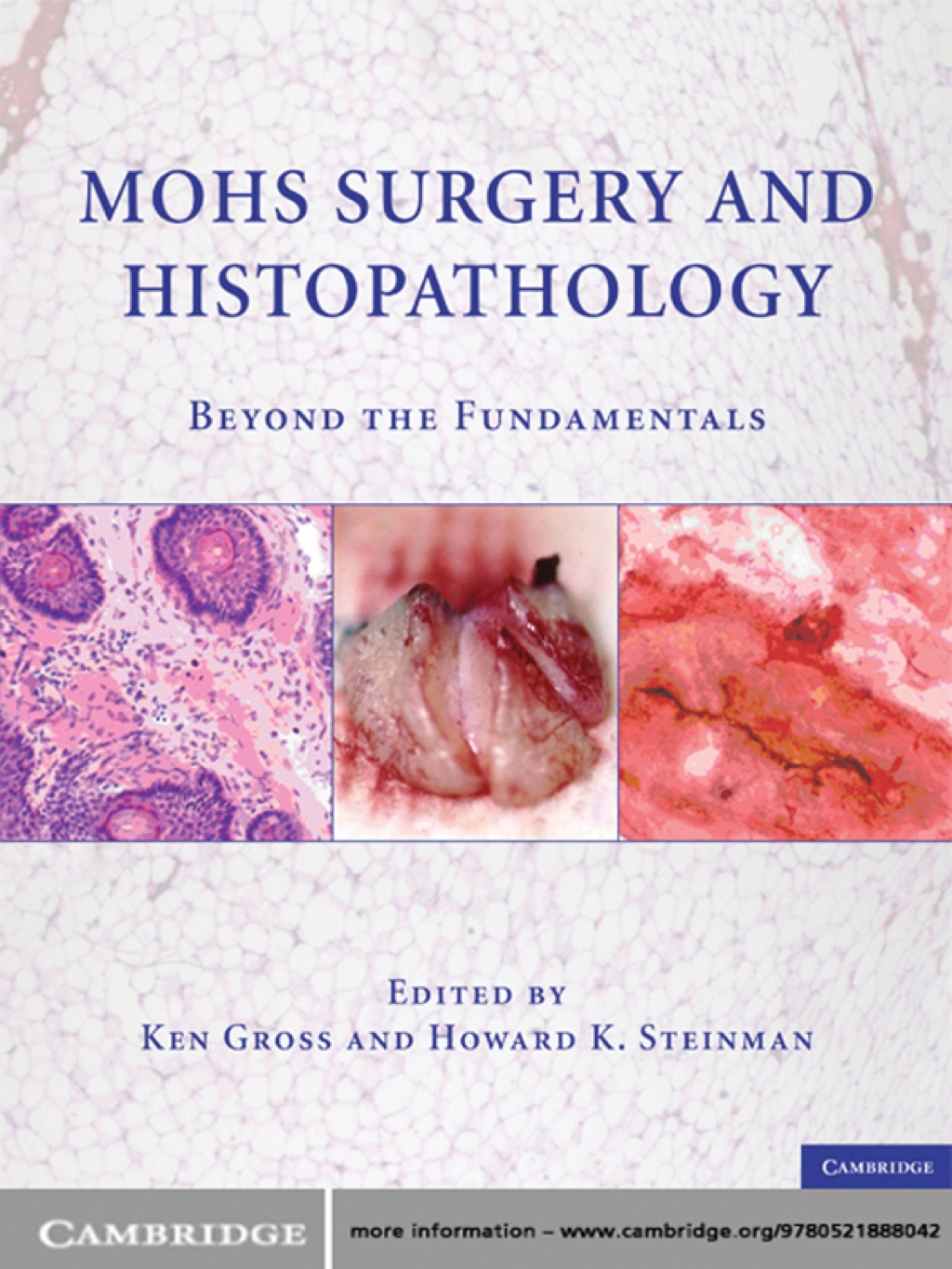 Mohs Surgery and Histopathology Beyond the Fundamentals 1st Edition â€“ PDF/EPUB Version Downloadable