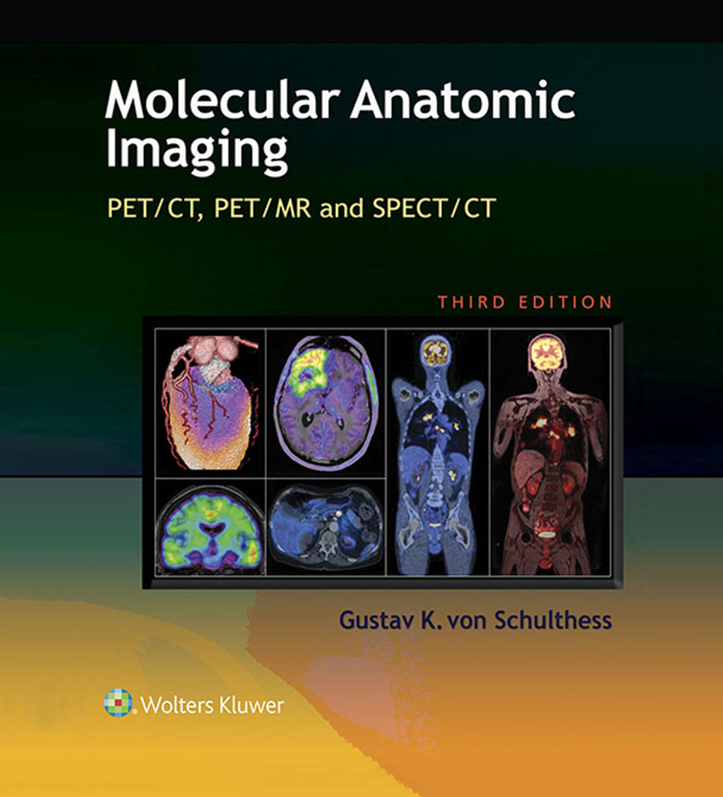 Molecular Anatomic Imaging PET/CT, PET/MR and SPECT CT 3rd Edition â€“ PDF/EPUB Version Downloadable
