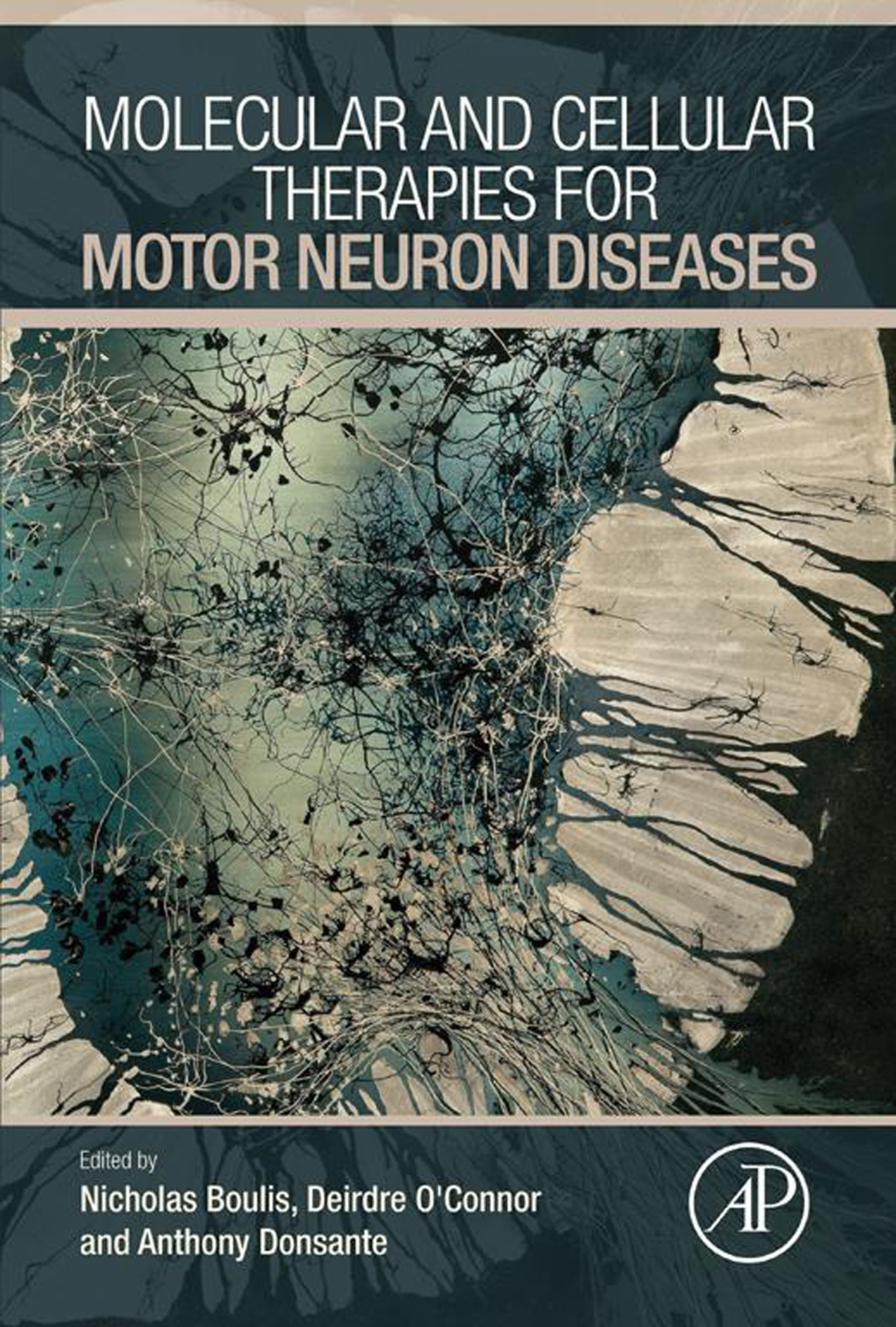 Molecular and Cellular Therapies for Motor Neuron Diseases  â€“ PDF/EPUB Version Downloadable