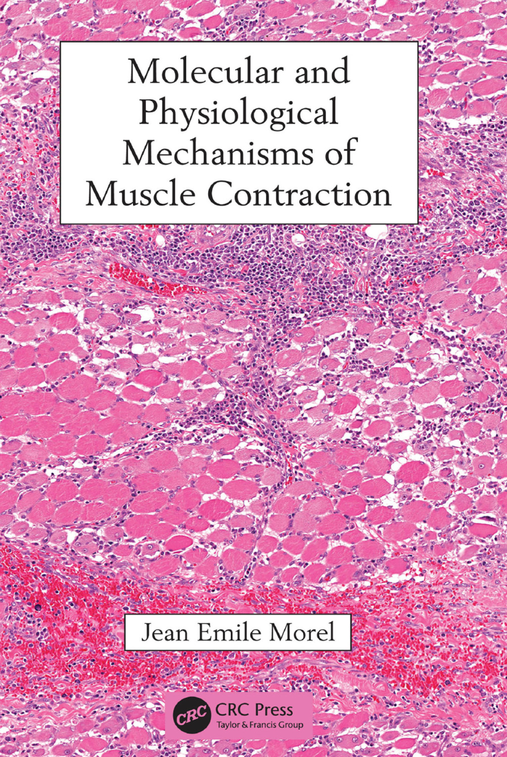 Molecular and Physiological Mechanisms of Muscle Contraction 1st ...