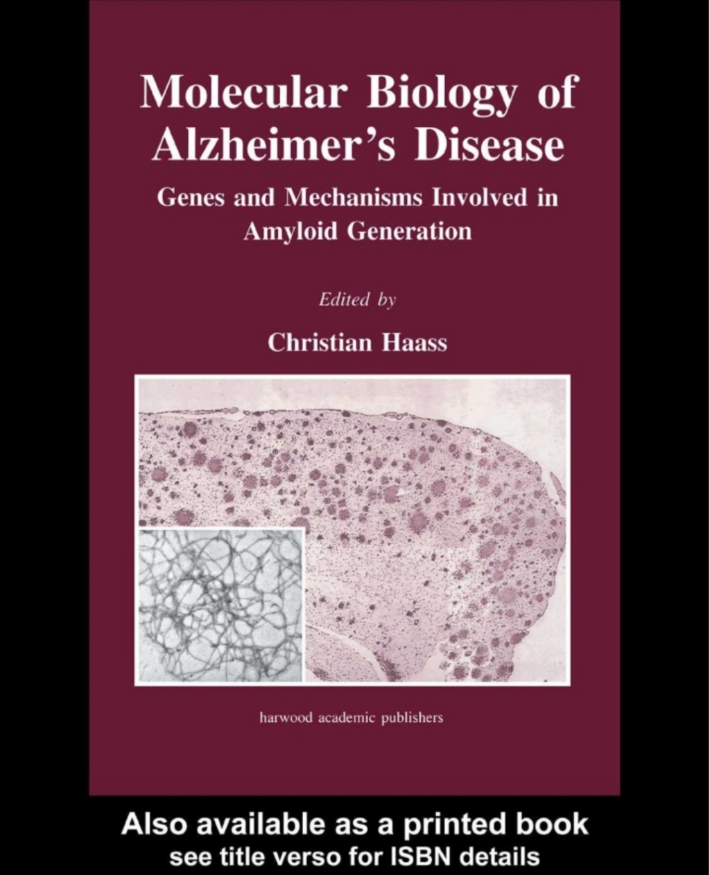 Molecular Biology of Alzheimer's Disease Genes and Mechanisms Involved in Amyloid Generation 1st Edition â€“ PDF/EPUB Version Downloadable