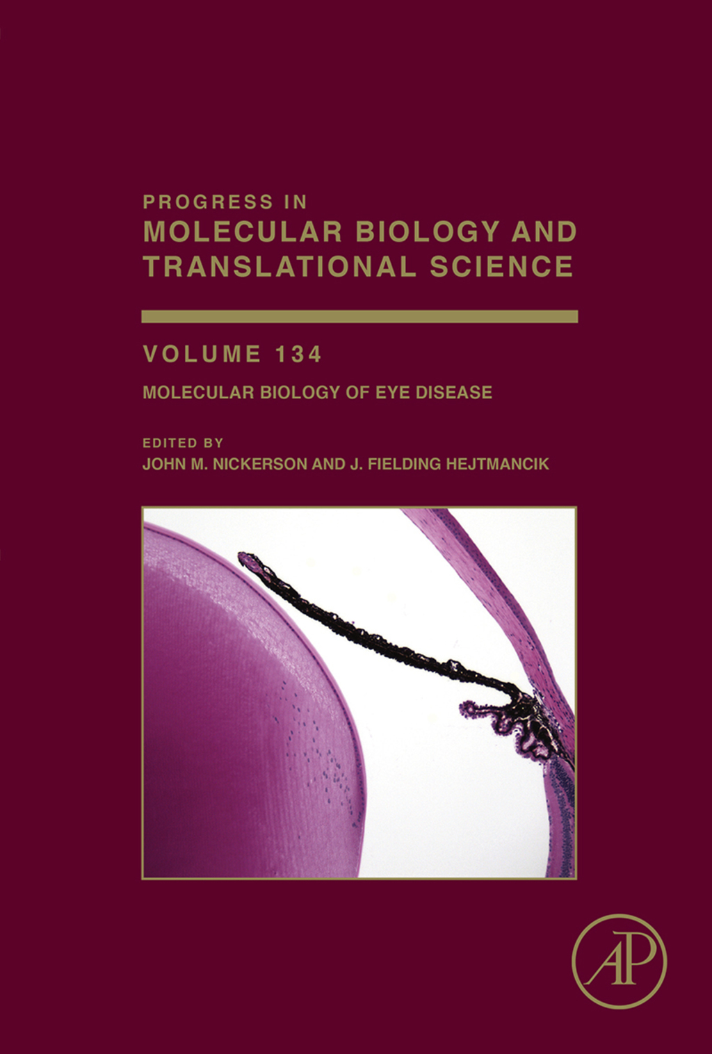 Molecular Biology of Eye Disease  â€“ PDF/EPUB Version Downloadable