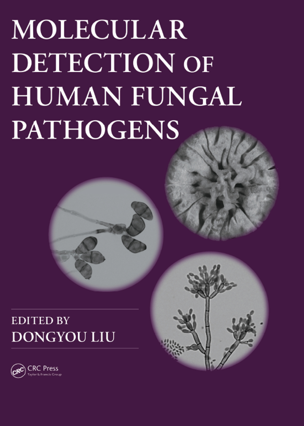 Molecular Detection of Human Fungal Pathogens 1st Edition â€“ PDF/EPUB Version Downloadable