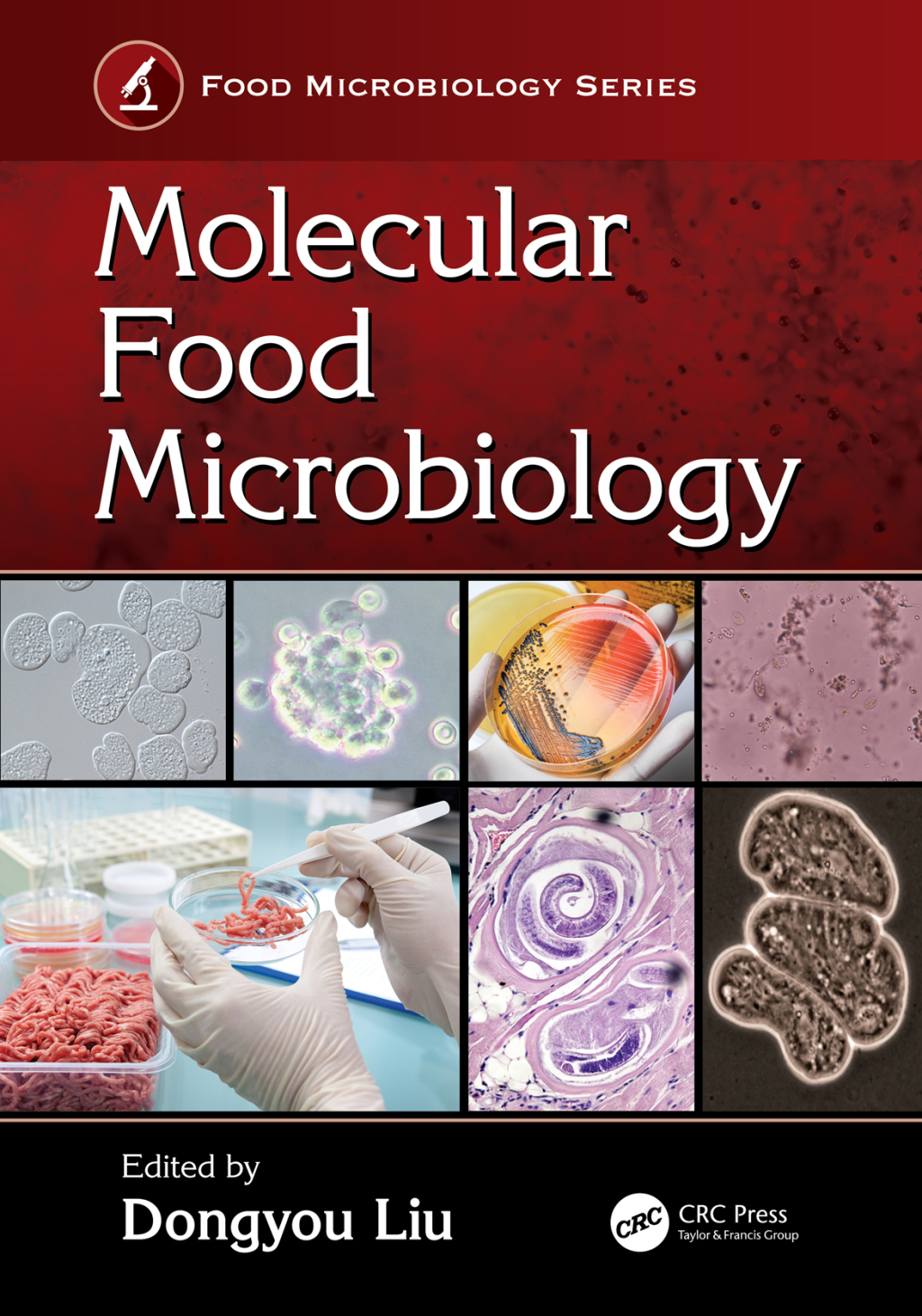 Molecular Food Microbiology 1st Edition â€“ PDF/EPUB Version Downloadable
