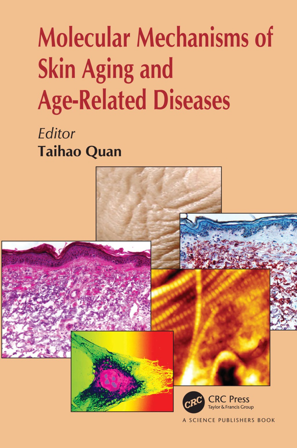 Molecular Mechanisms of Skin Aging and Age-Related Diseases 1st Edition ...