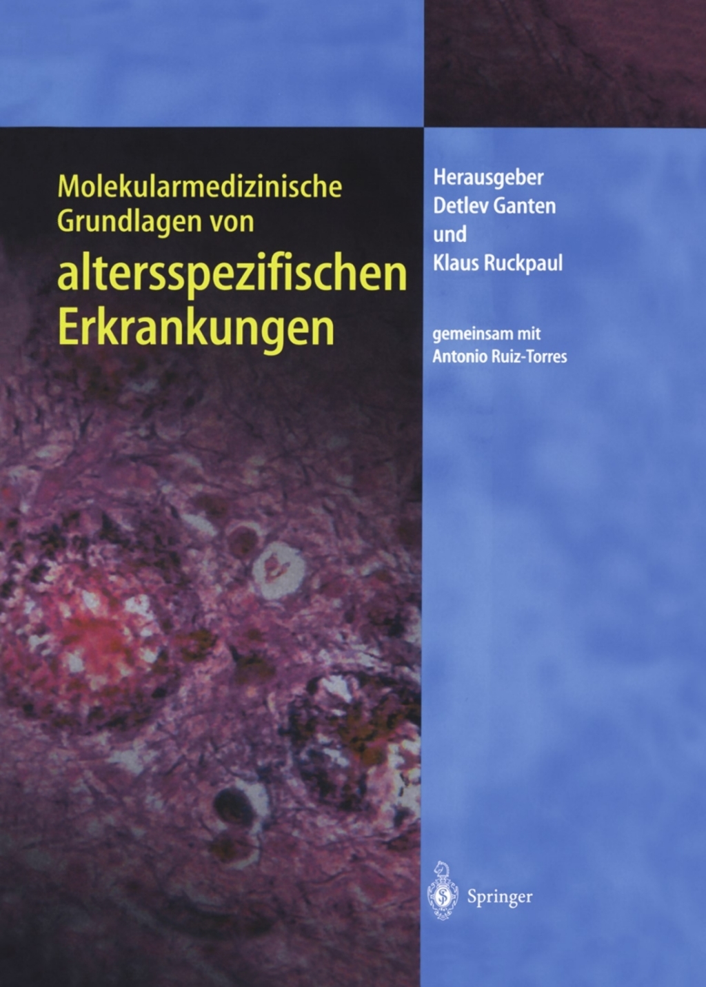 Molekularmedizinische Grundlagen von altersspezifischen Erkrankungen 1st Edition â€“ PDF/EPUB Version Downloadable