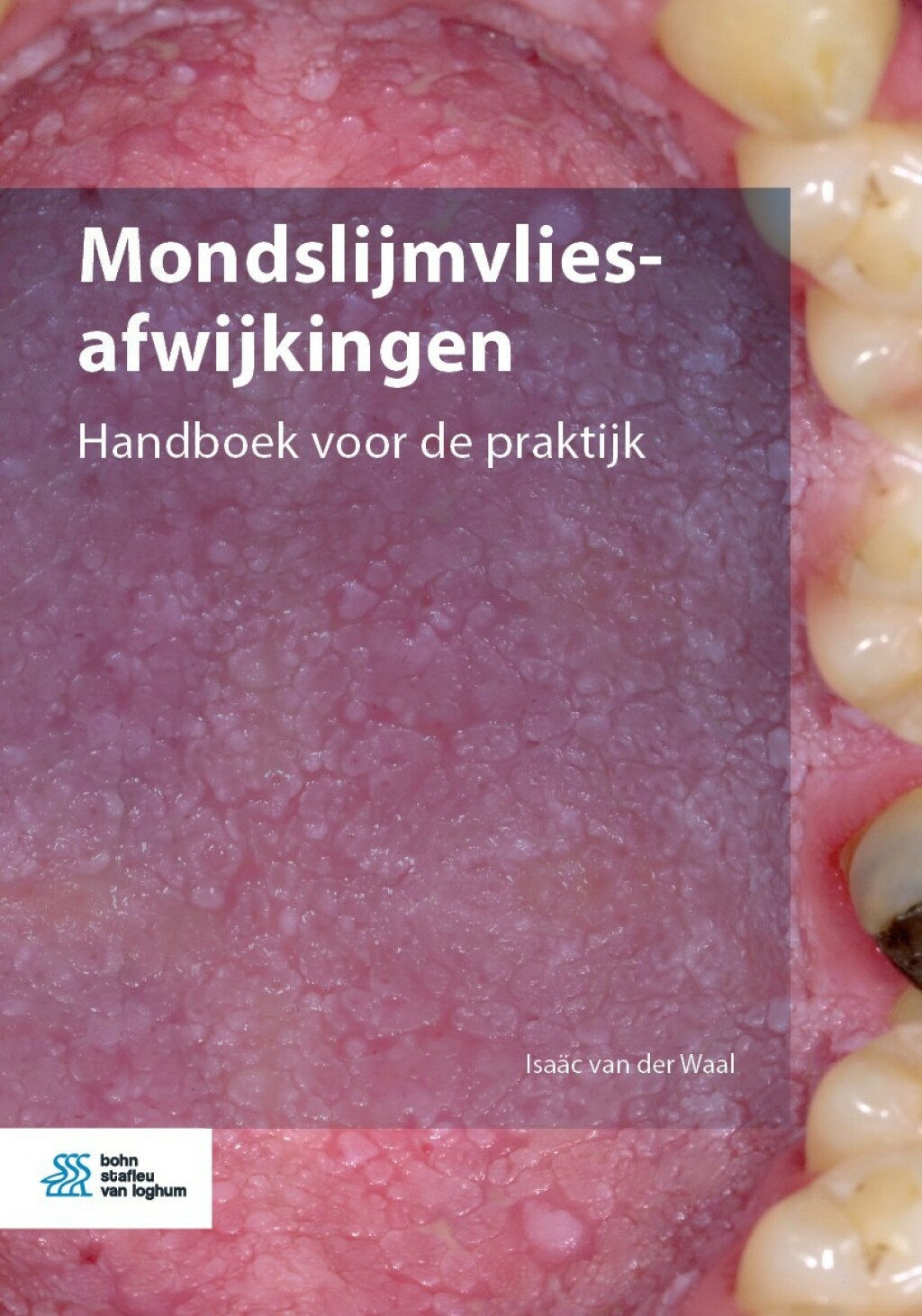 Mondslijmvliesafwijkingen Handboek voor de praktijk  â€“ PDF/EPUB Version Downloadable