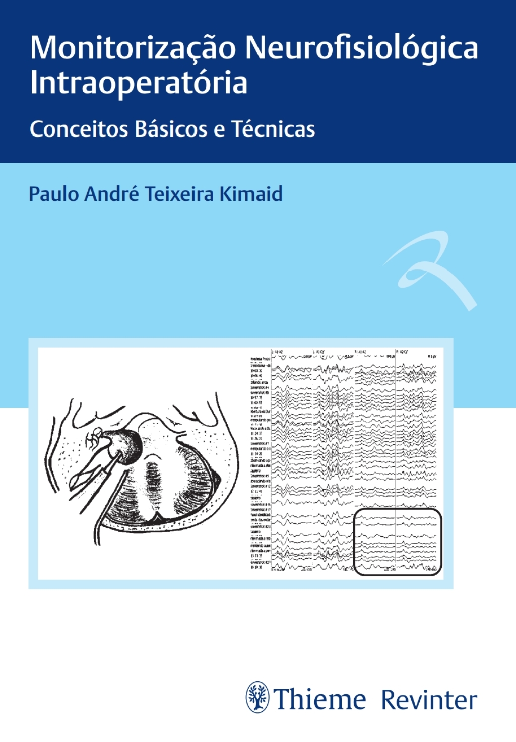 MonitorizaÃ§Ã£o NeurofisiolÃ³gica IntraoperatÃ³ria: Conceitos BÃ¡sicos e TÃ©cnicas 1st Edition â€“ PDF/EPUB Version Downloadable
