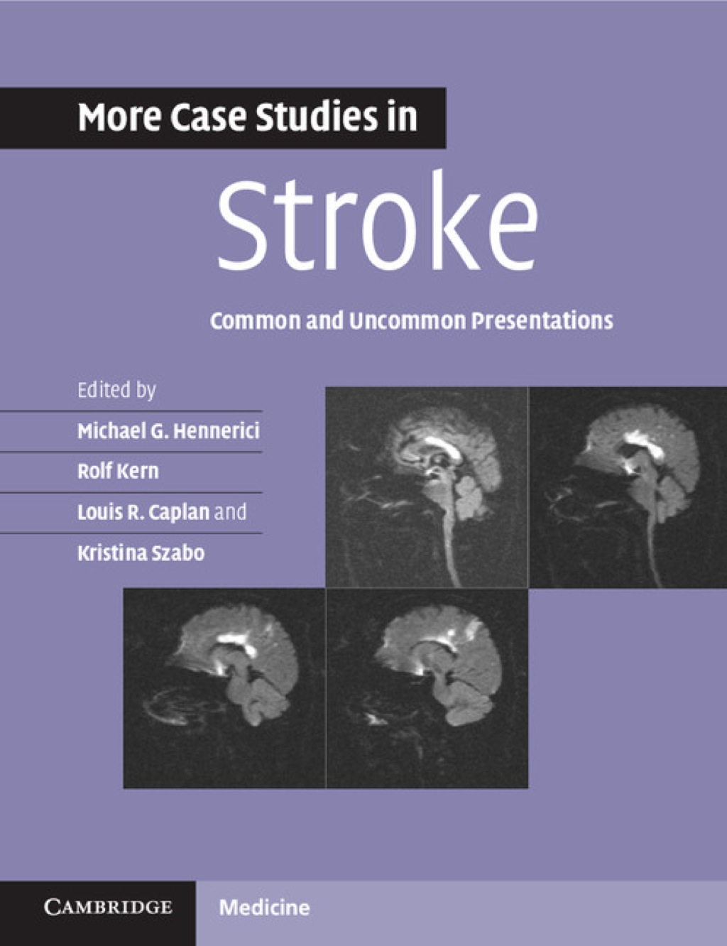 More Case Studies in Stroke Common and Uncommon Presentations 1st Edition â€“ PDF/EPUB Version Downloadable