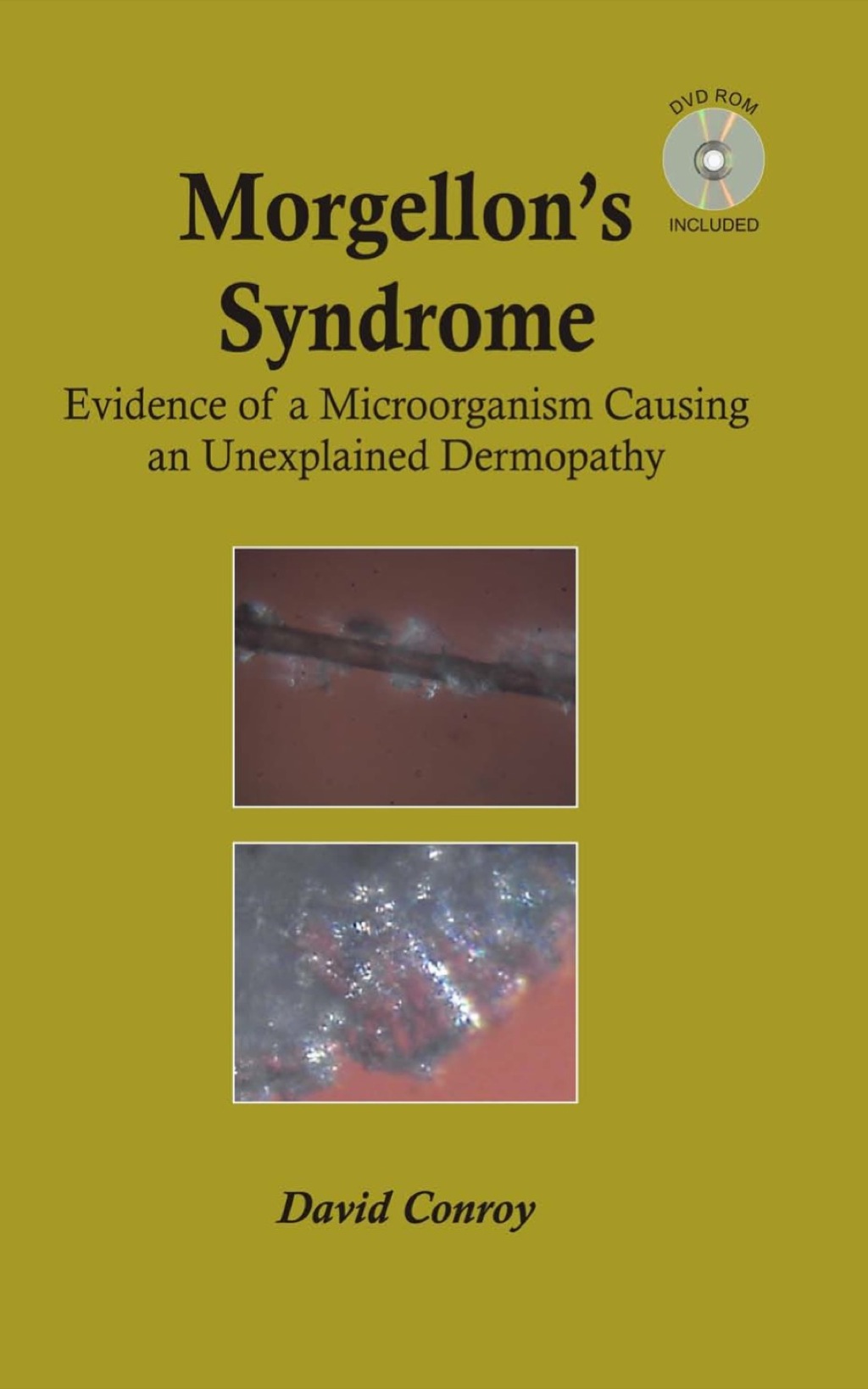 Morgellon's Syndrome 1st Edition â€“ PDF/EPUB Version Downloadable
