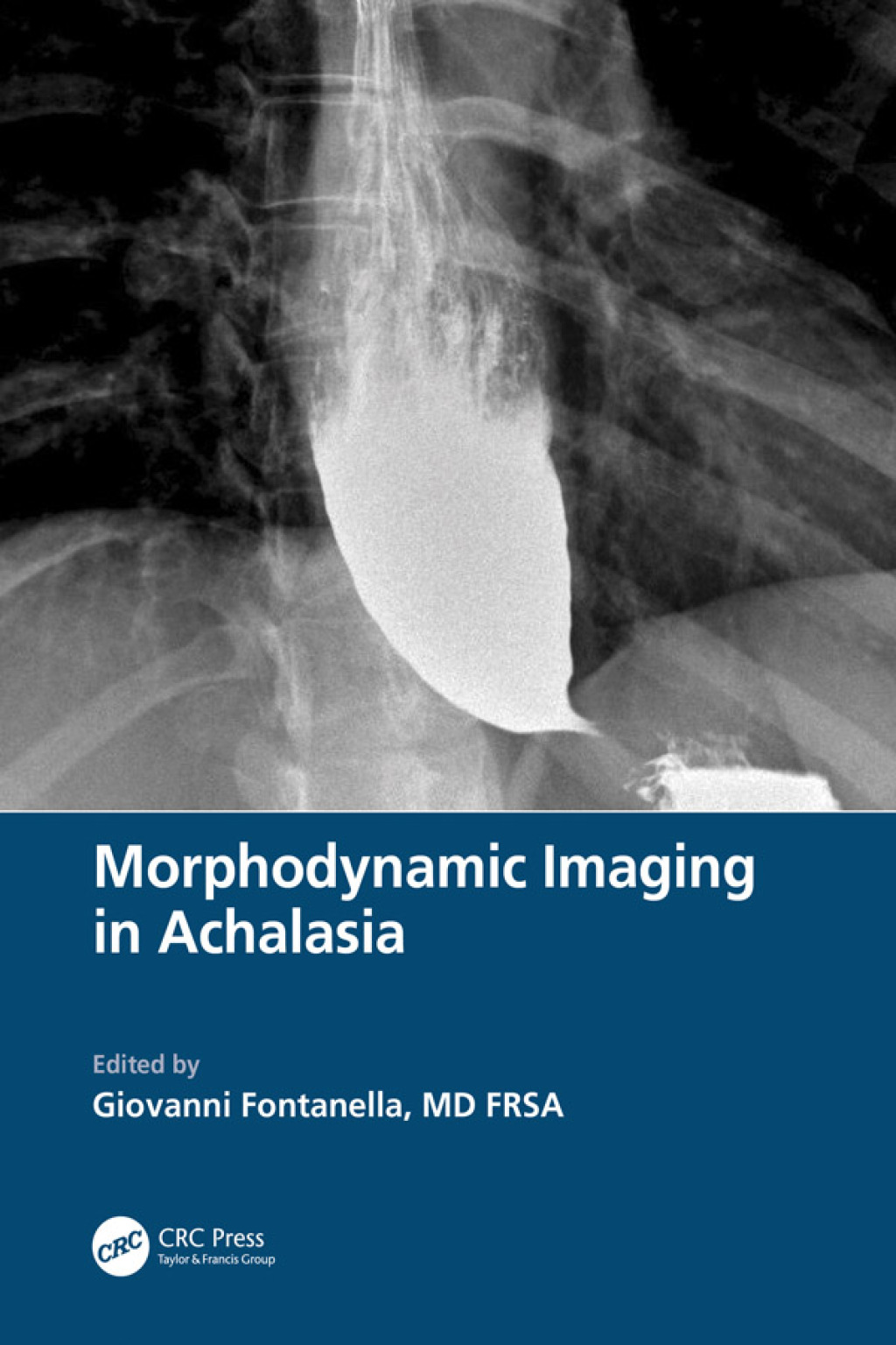 Morphodynamic Imaging in Achalasia 1st Edition â€“ PDF/EPUB Version Downloadable