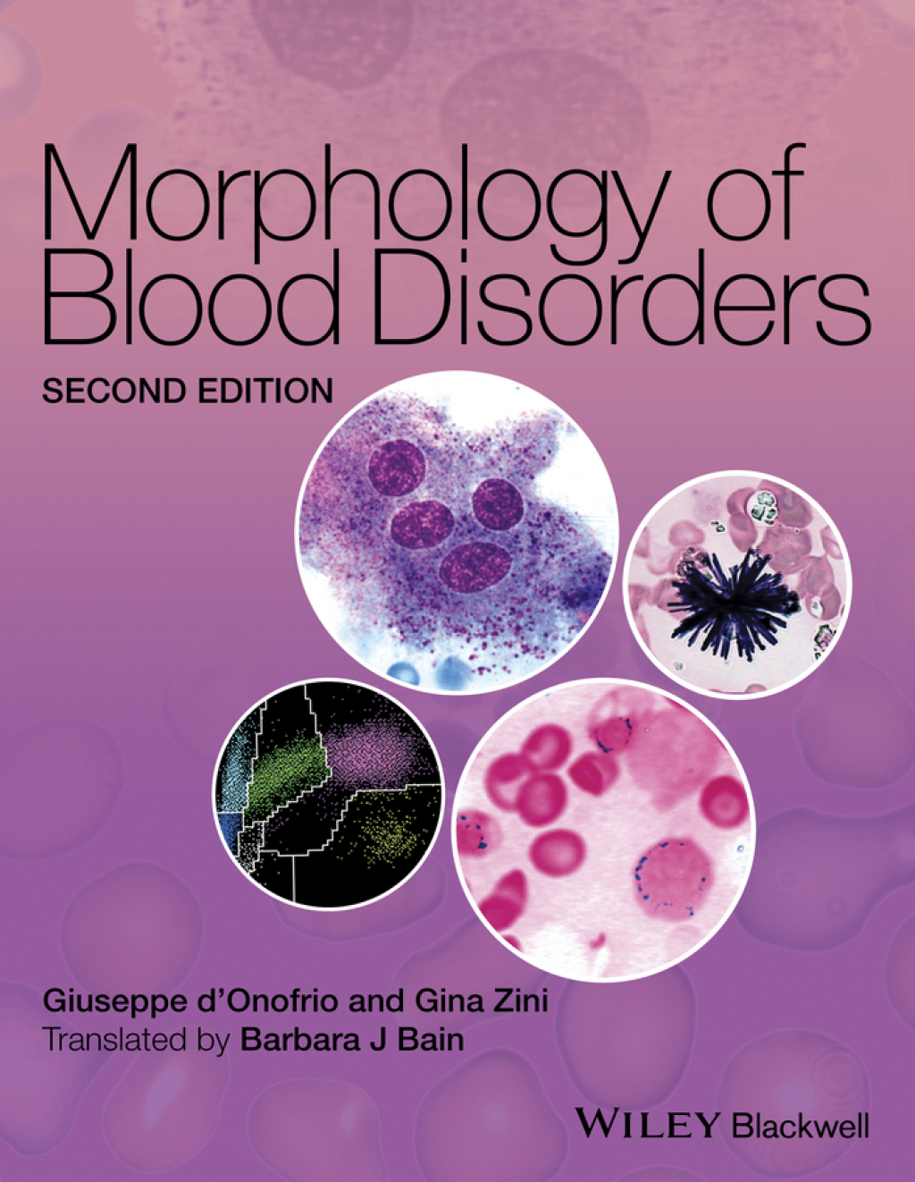 Morphology of Blood Disorders 2nd Edition – PDF/EPUB Version Downloadable