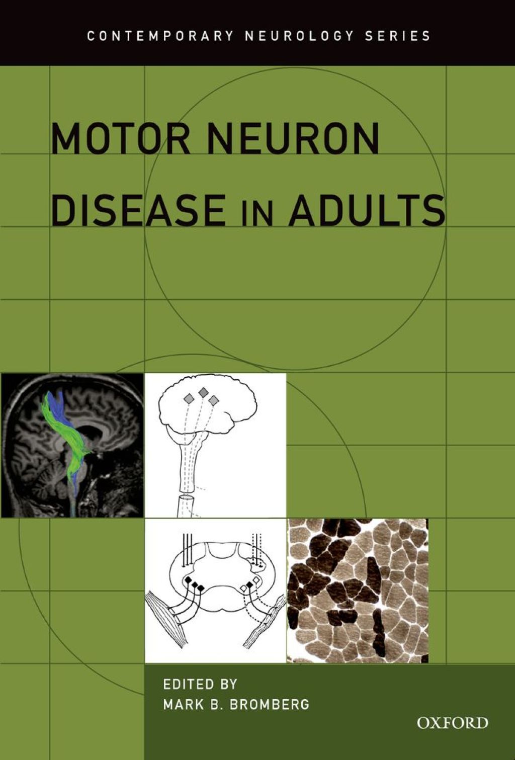 Motor Neuron Disease in Adults 1st Edition â€“ PDF/EPUB Version Downloadable