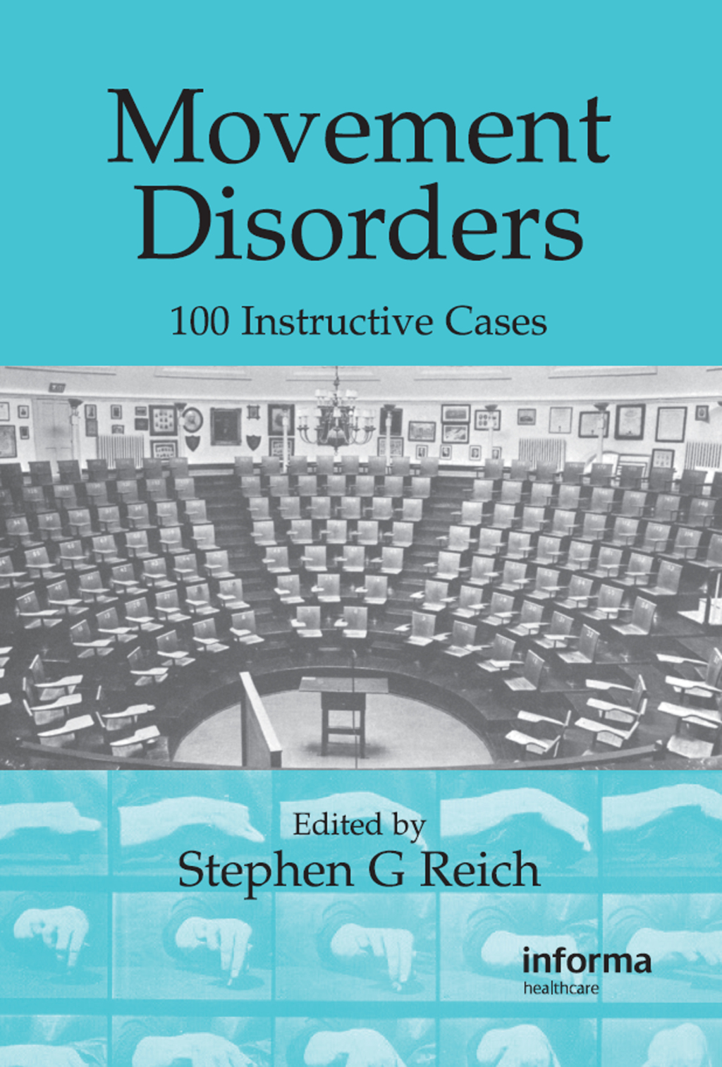 Movement Disorders 100 Instructive Cases 1st Edition â€“ PDF/EPUB Version Downloadable