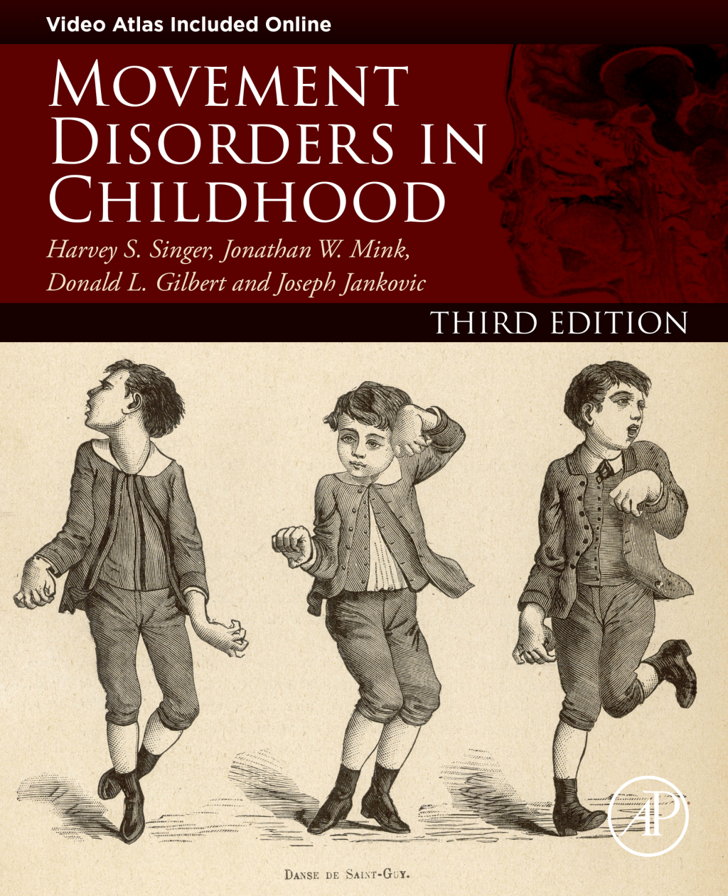 Movement Disorders in Childhood 3rd Edition â€“ PDF/EPUB Version Downloadable