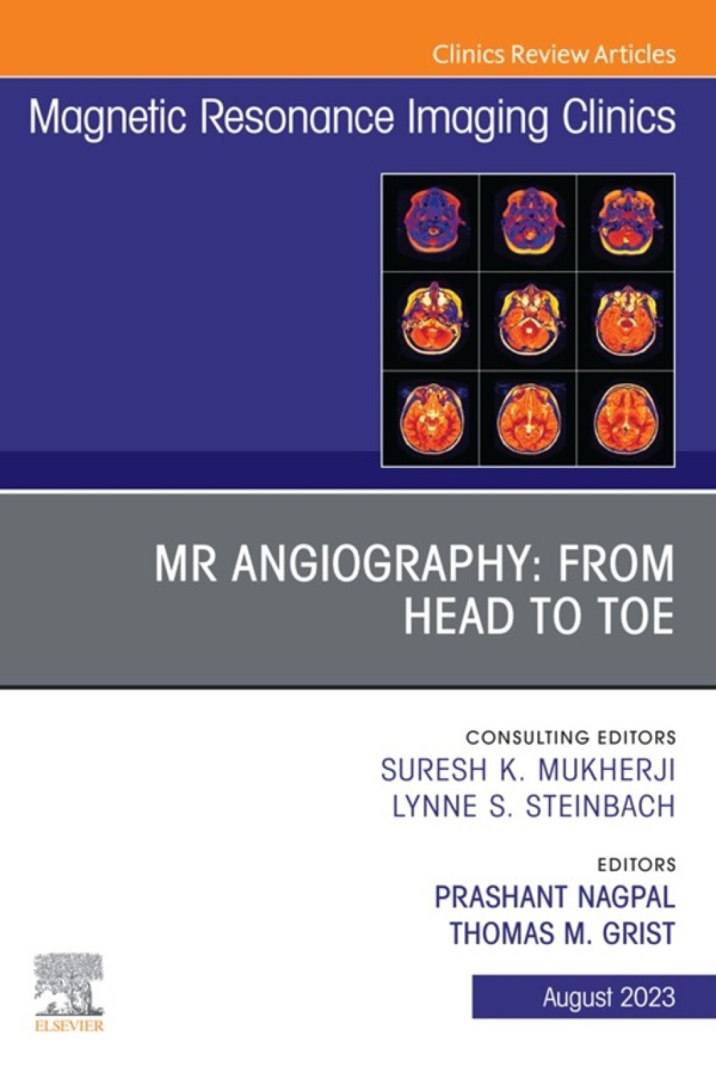 MR Angiography: From Head to Toe, An Issue of Magnetic Resonance Imaging Clinics of North America 1st Edition â€“ PDF/EPUB Version Downloadable