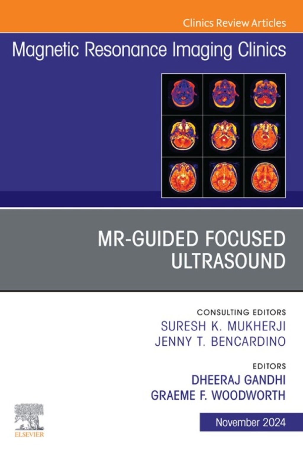 MR-Guided Focused Ultrasound, An Issue of Magnetic Resonance Imaging Clinics of North America 1st Edition â€“ PDF/EPUB Version Downloadable