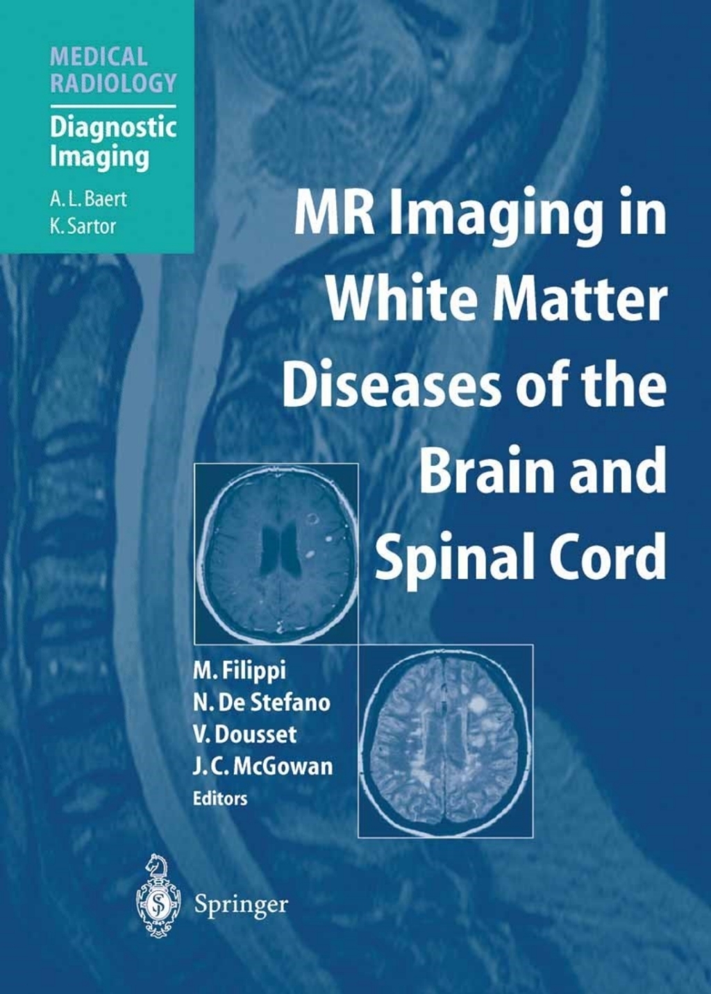 MR Imaging in White Matter Diseases of the Brain and Spinal Cord 1st Edition â€“ PDF/EPUB Version Downloadable