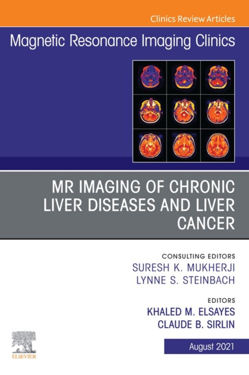 MR Imaging of Chronic Liver Diseases and Liver Cancer, An Issue of Magnetic Resonance Imaging Clinics of North America  â€“ PDF/EPUB Version Downloadable