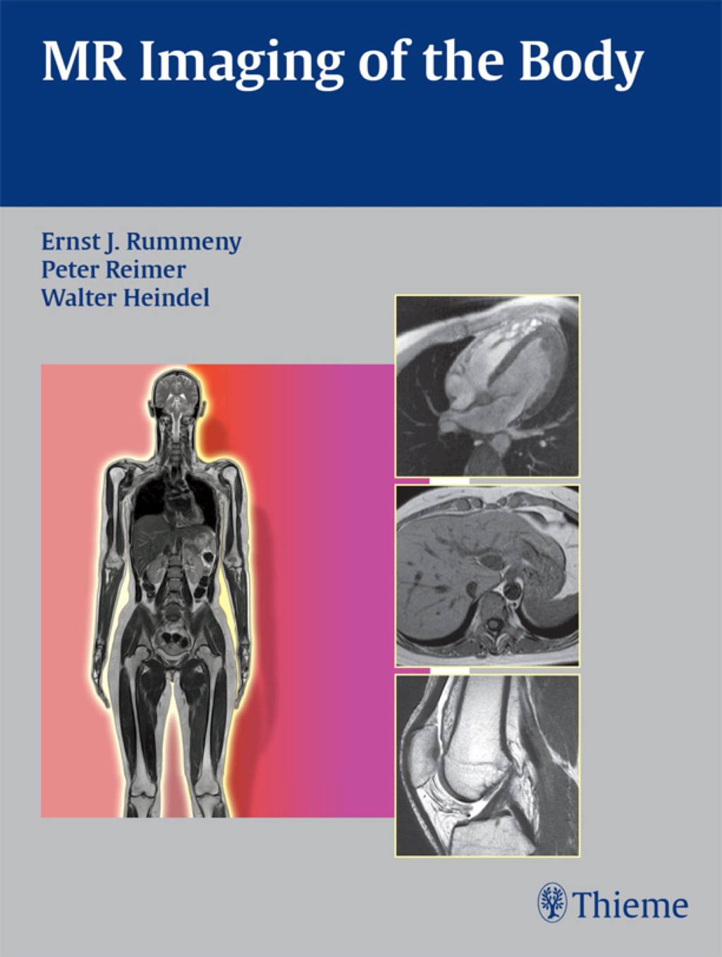 MR Imaging of the Body 1st Edition â€“ PDF/EPUB Version Downloadable