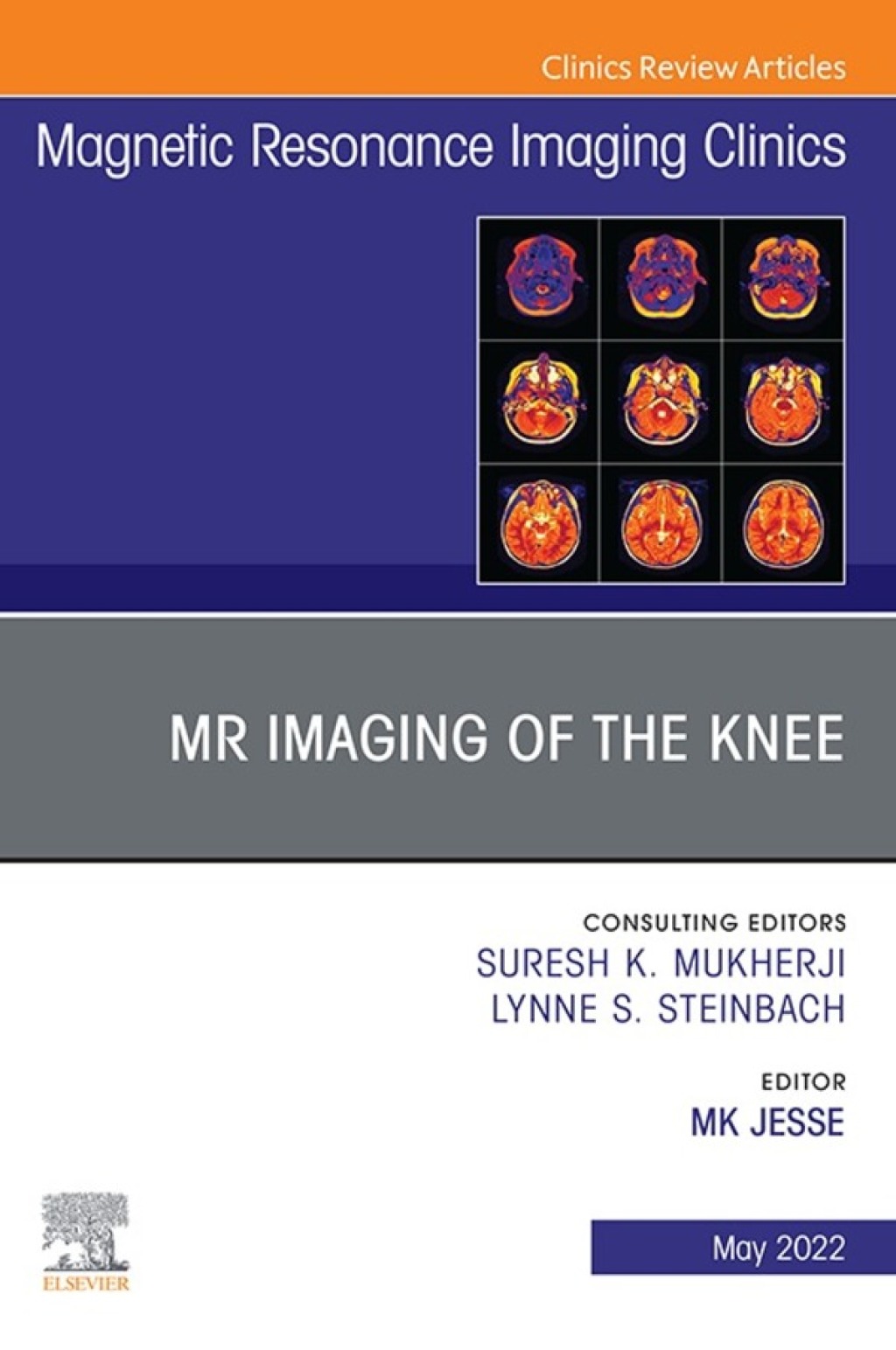 MR Imaging of The Knee, An Issue of Magnetic Resonance Imaging Clinics of North America  â€“ PDF/EPUB Version Downloadable