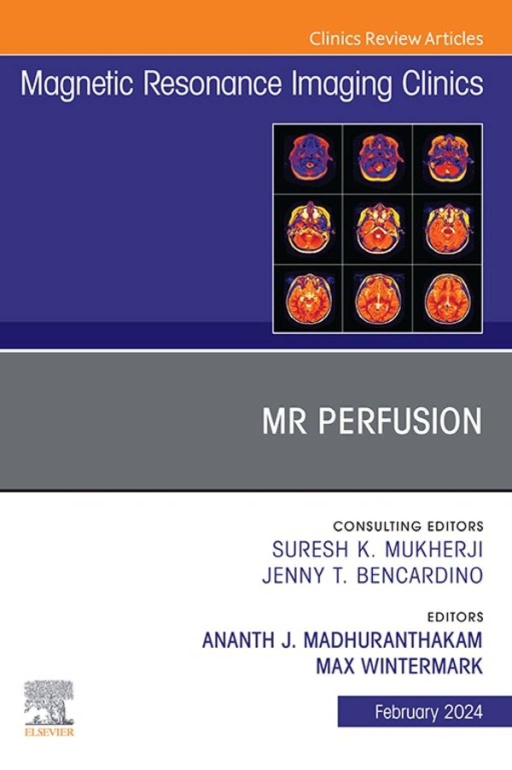 MR Perfusion, An Issue of Magnetic Resonance Imaging Clinics of North America 1st Edition â€“ PDF/EPUB Version Downloadable